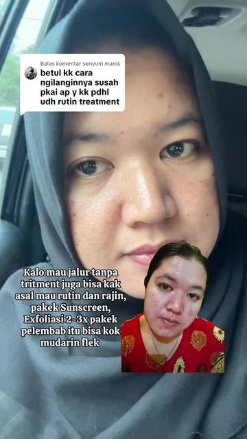 @ita_skinjourney