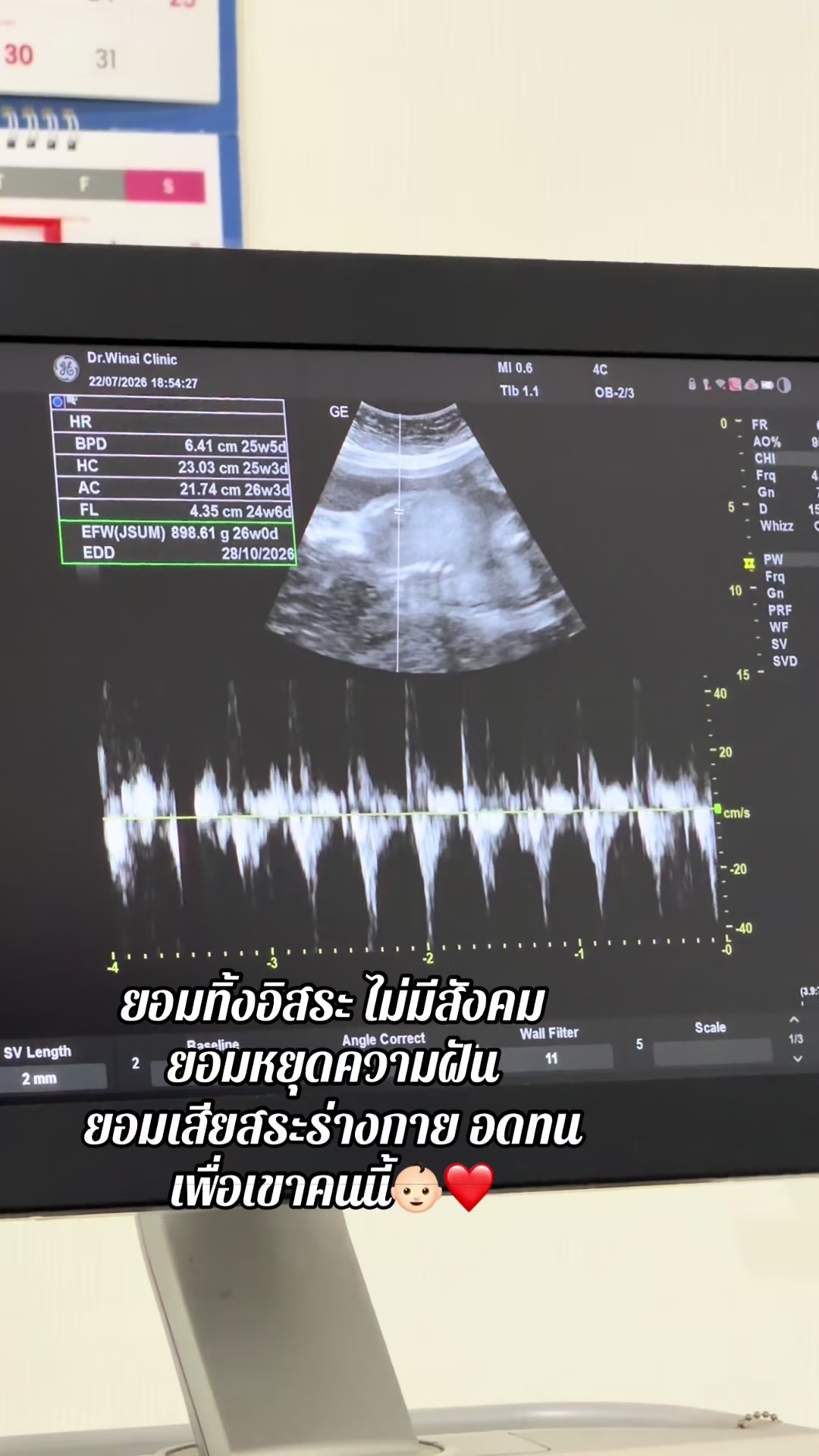 @เป้ที่ไม่ใช่กระเป๋า☺️🖤