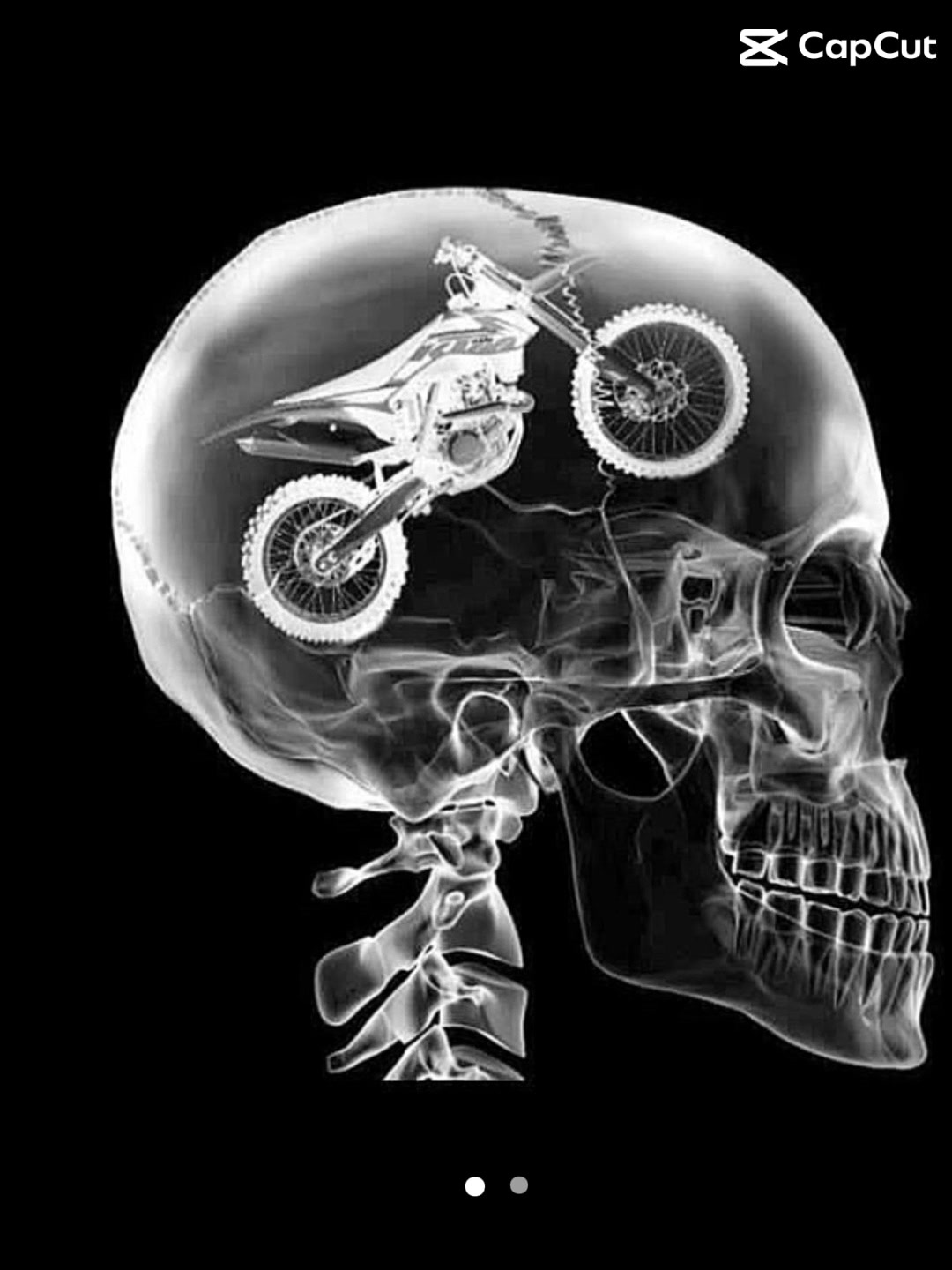 @@TM MX RACING 85