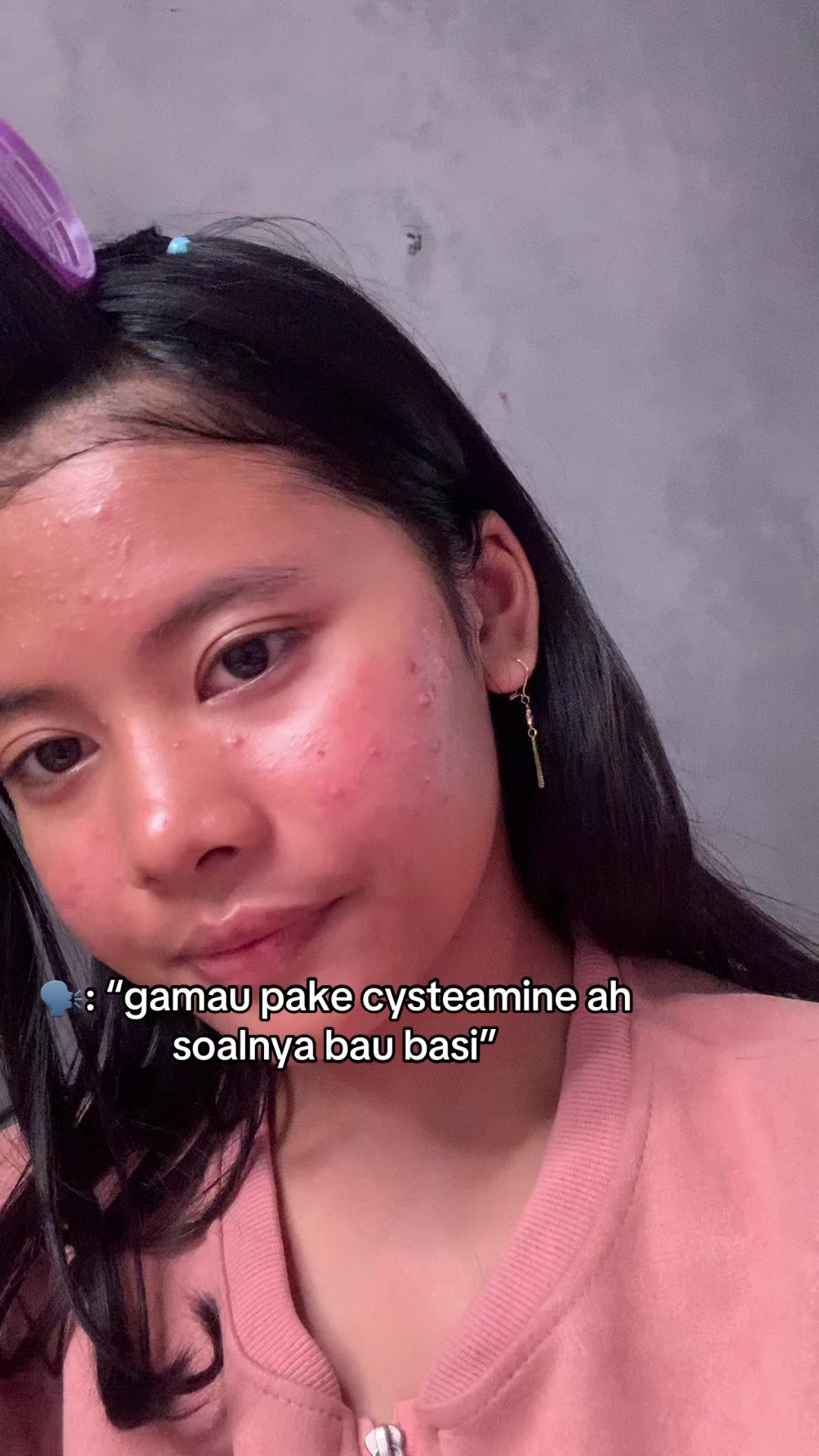 @Dheaalmaira