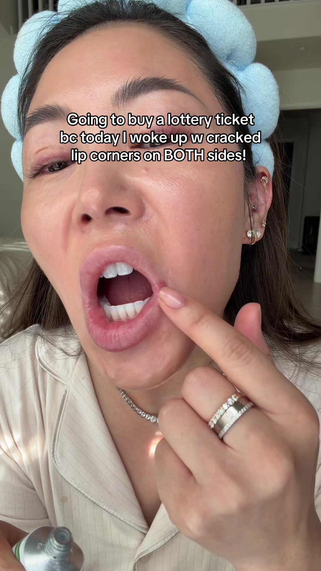 @Joycethedentist OC Veneers