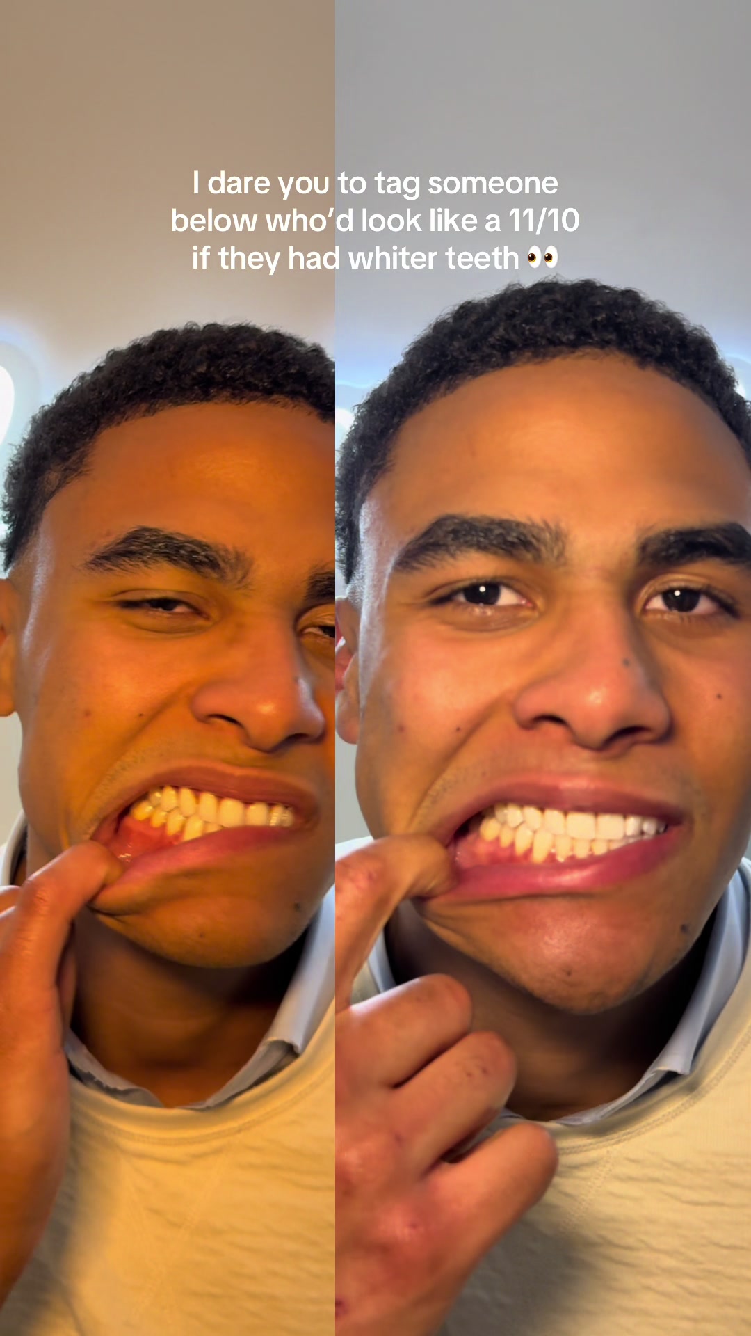 @Halal Teeth Whitening London
