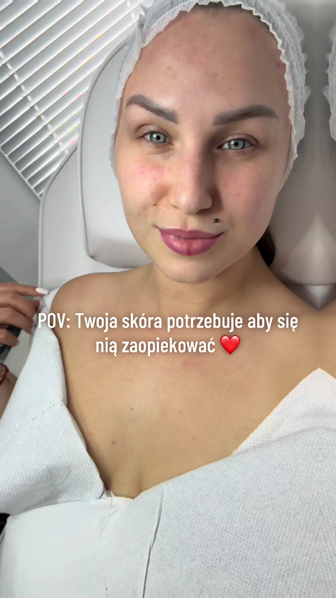 @BeautyBerryClinic_ByJagoda
