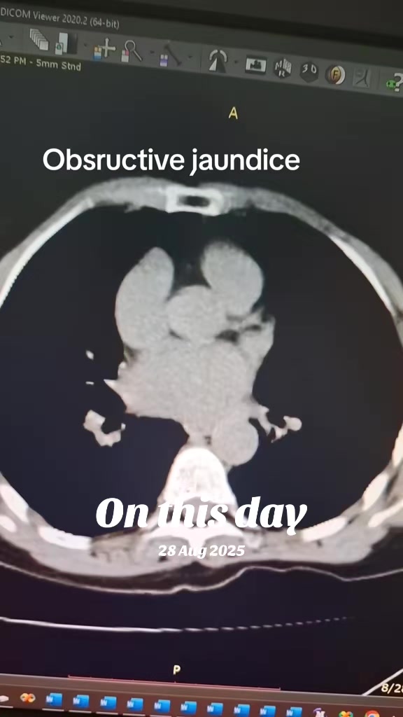 @Dr Wubie Endalew(Radiologist)