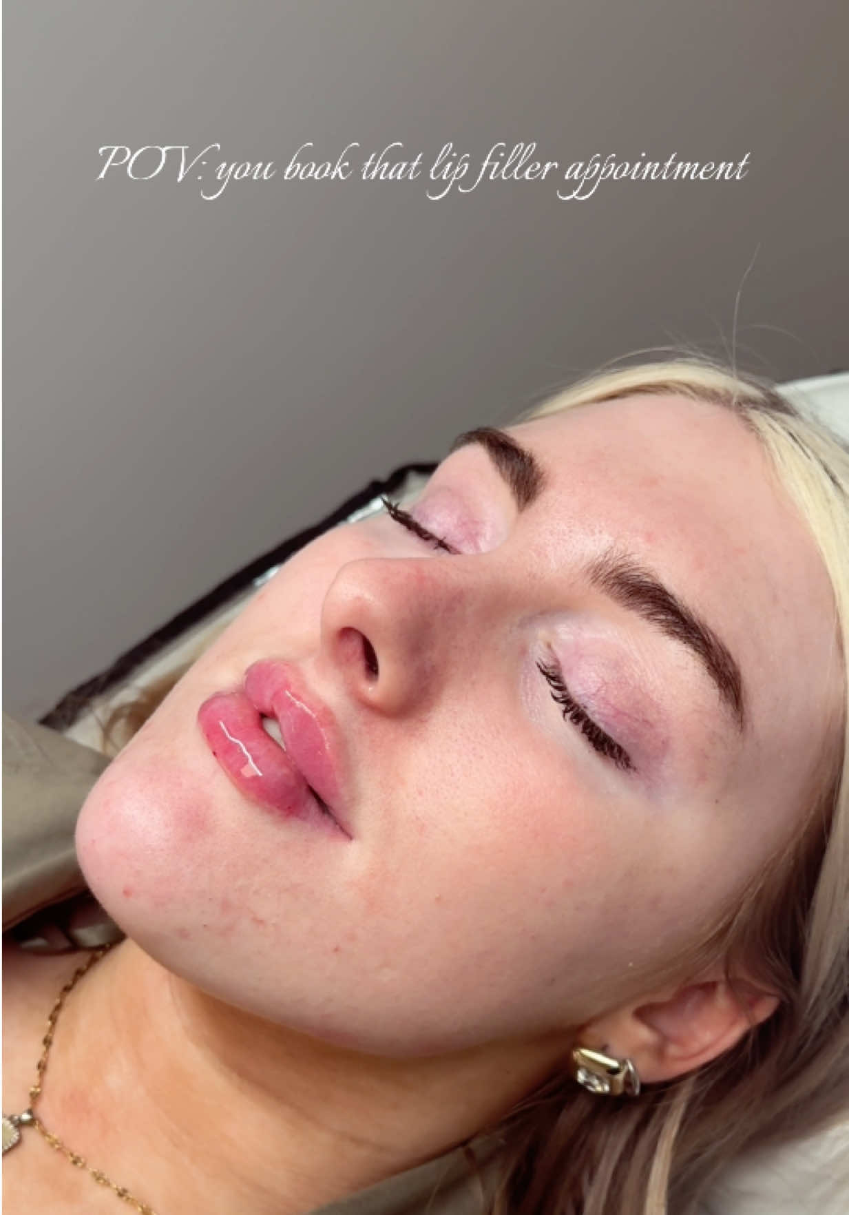 @ALS Aesthetics