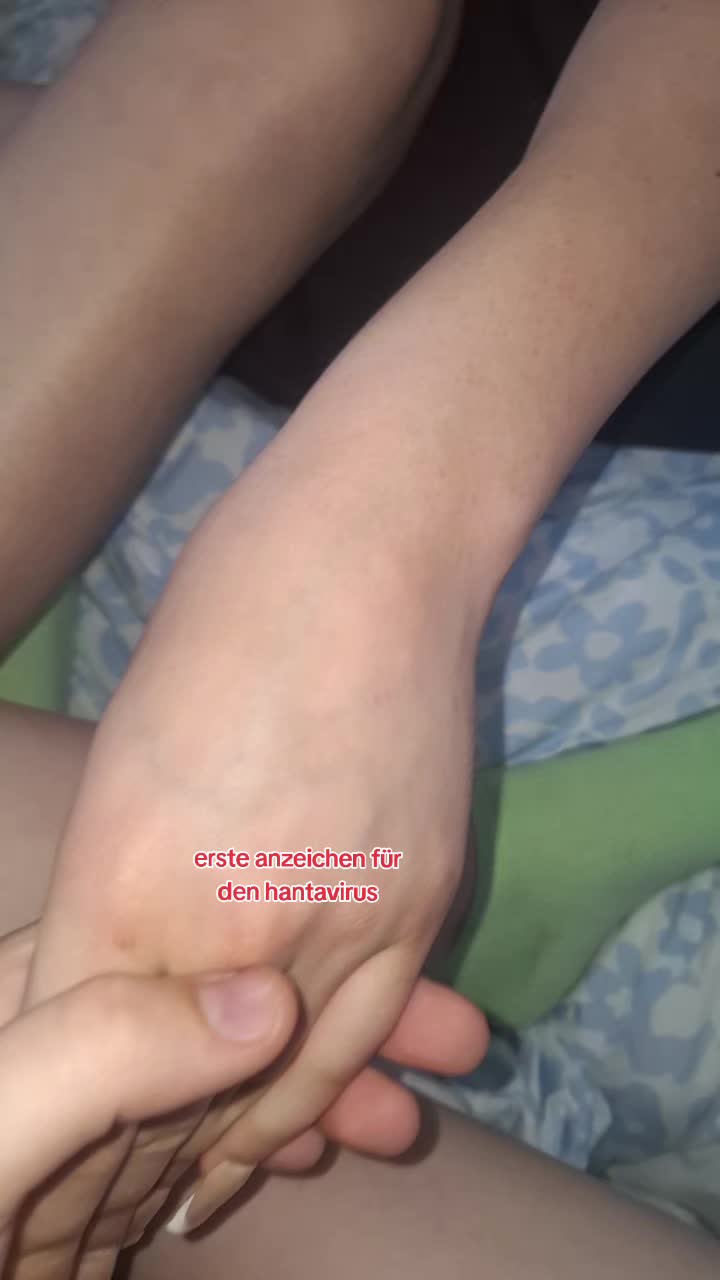 @Kimi