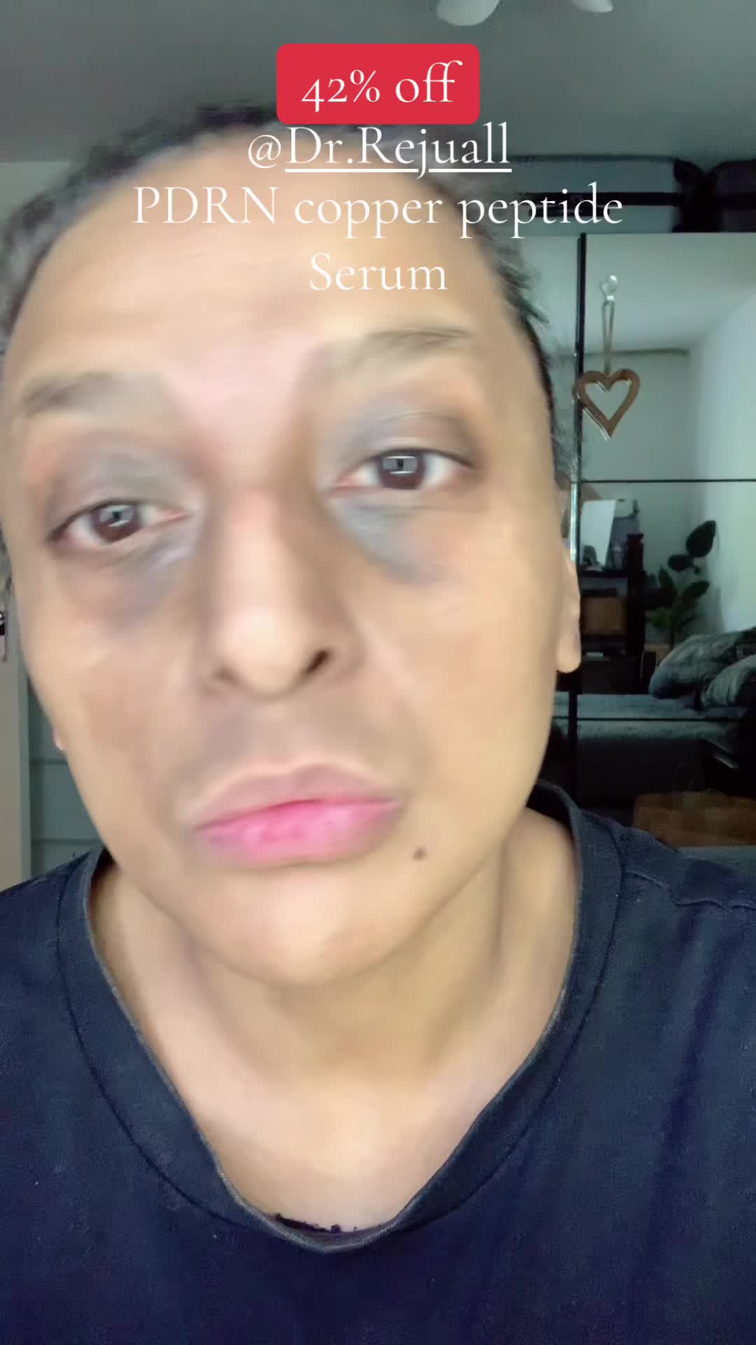 @Billeegene