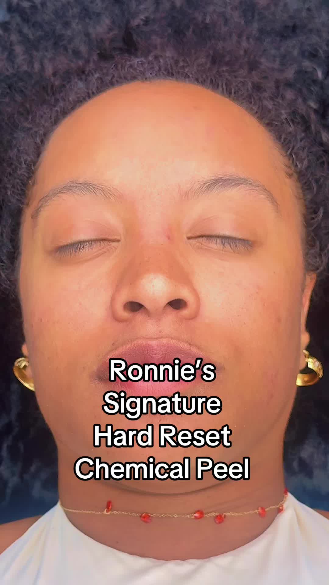 @Ronnie