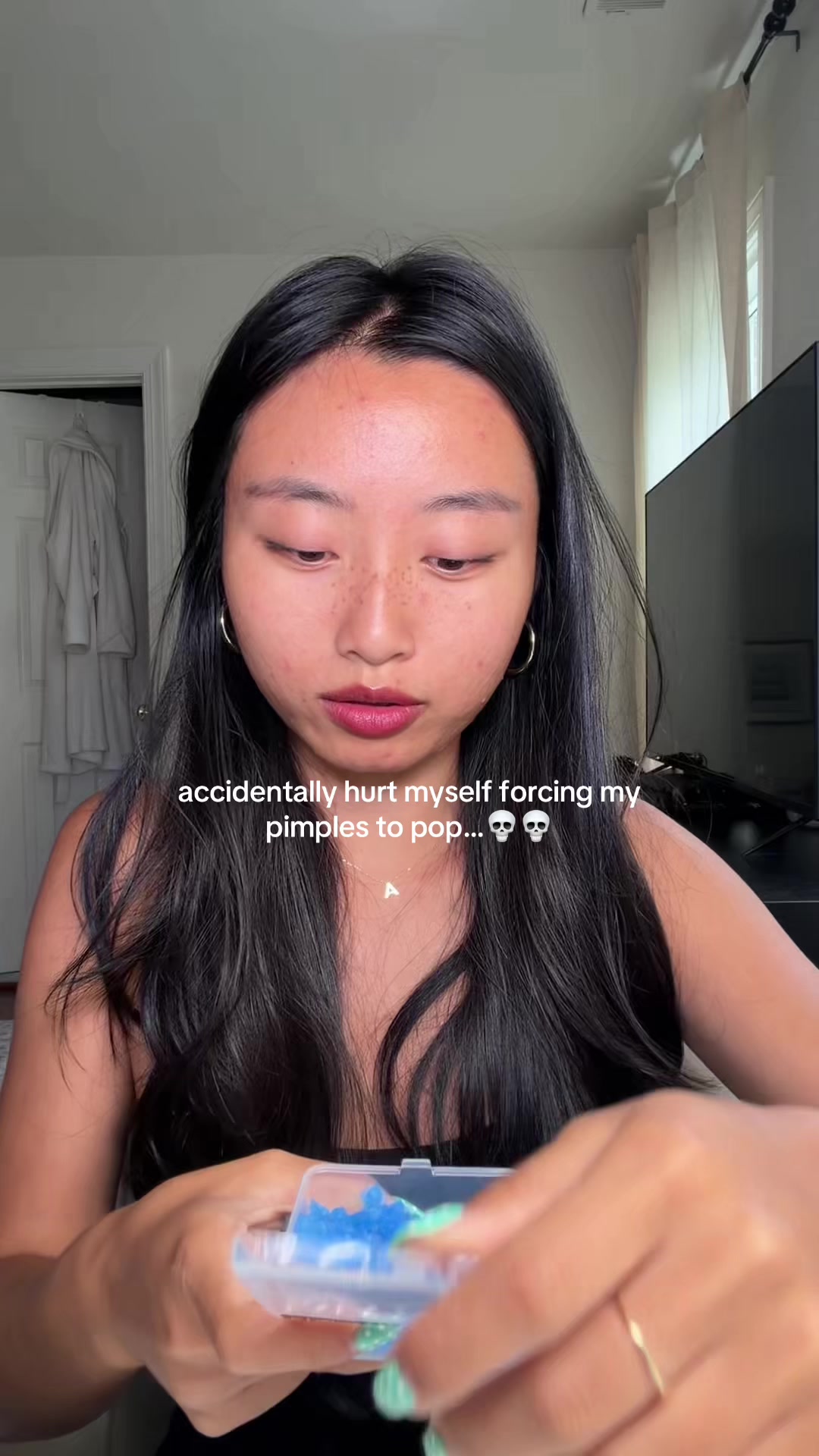@ALLIE CHEN โ