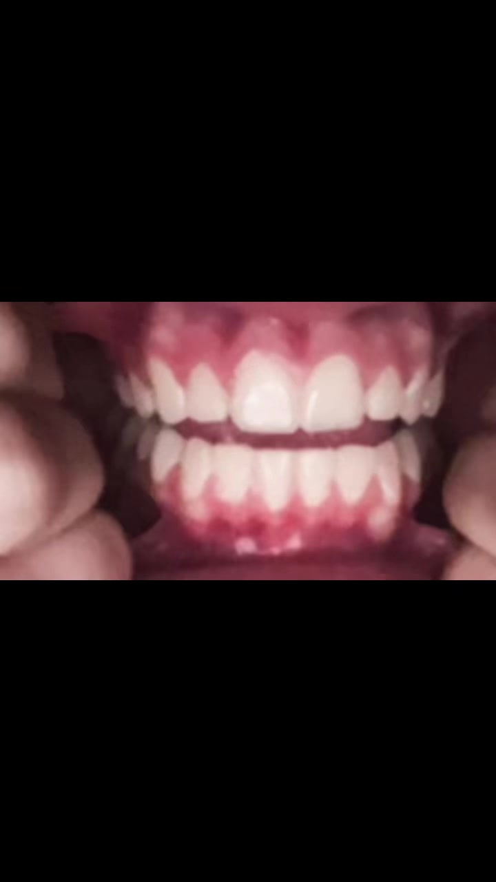 @♱𝕸𝖔𝖓𝖘𝖙𝖊𝖗𝖗♱