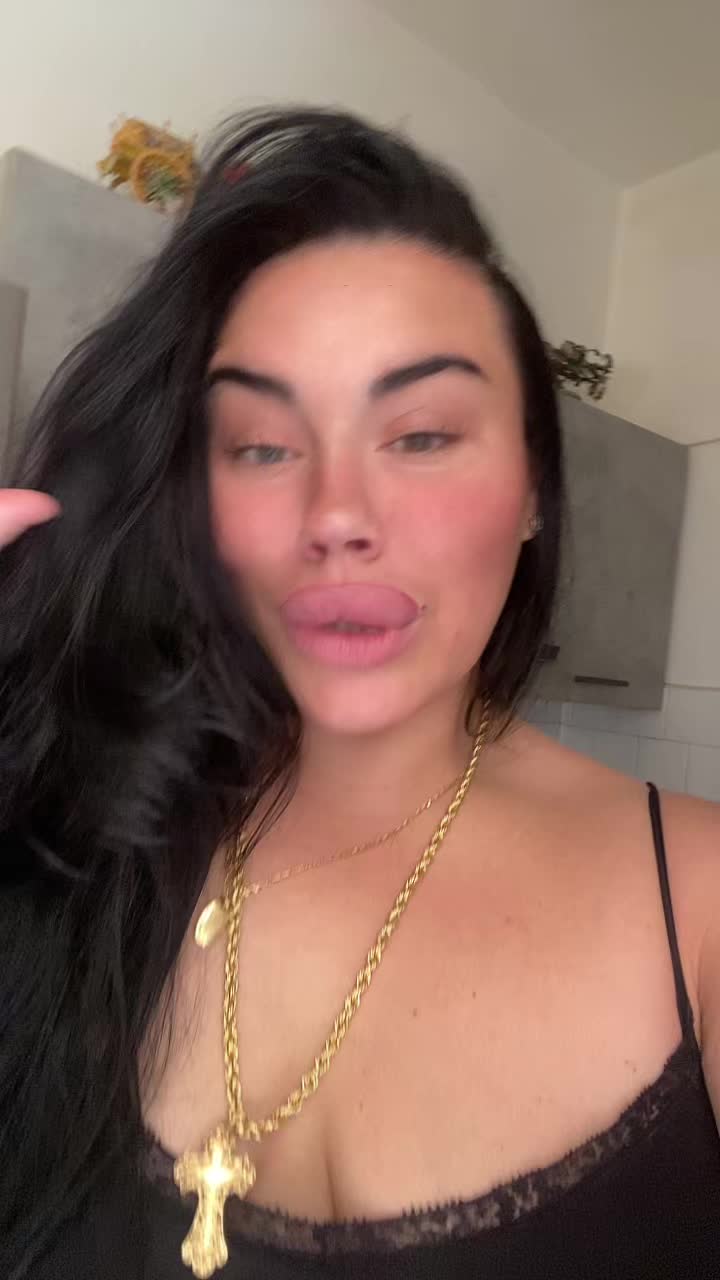 @Alessia albino