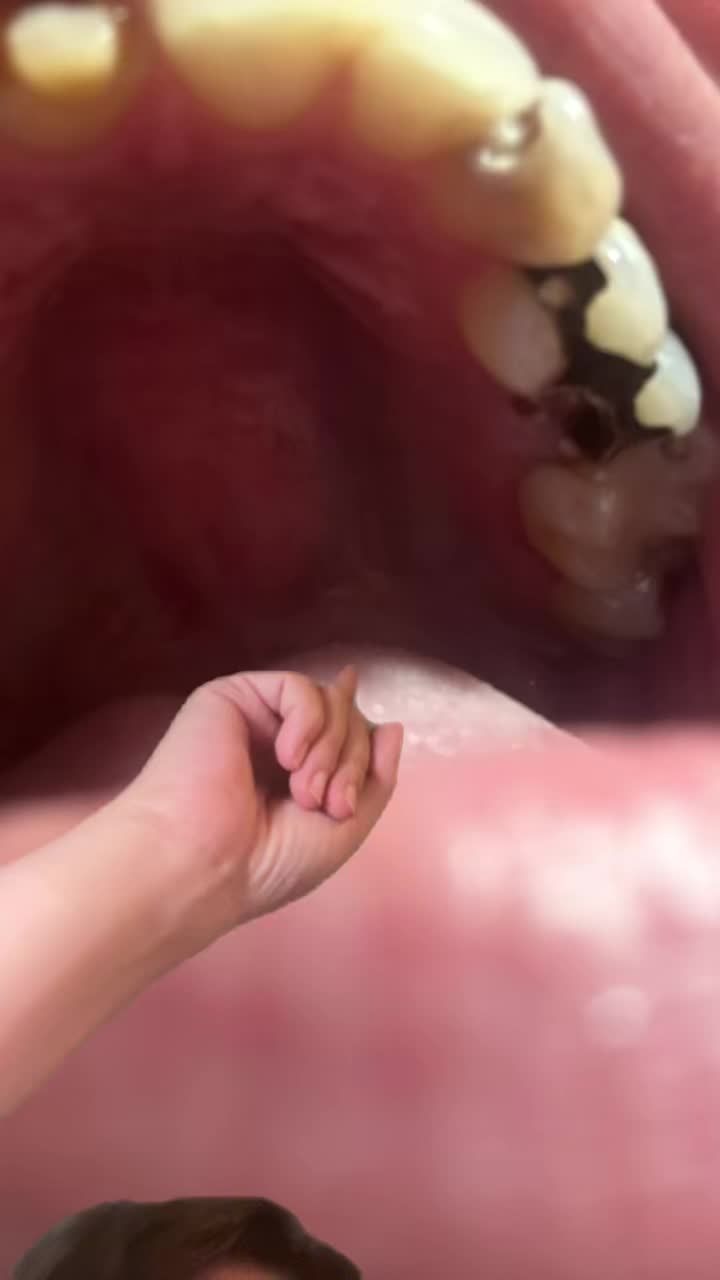 @TruthInMyTeeth