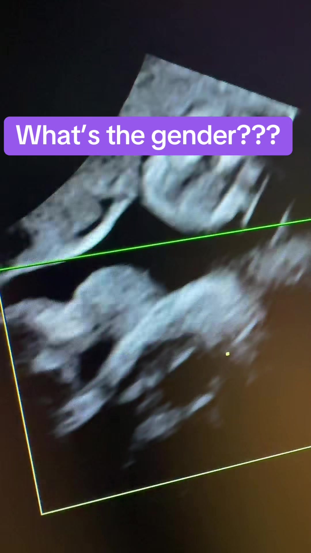 @PregnantSee Inc.