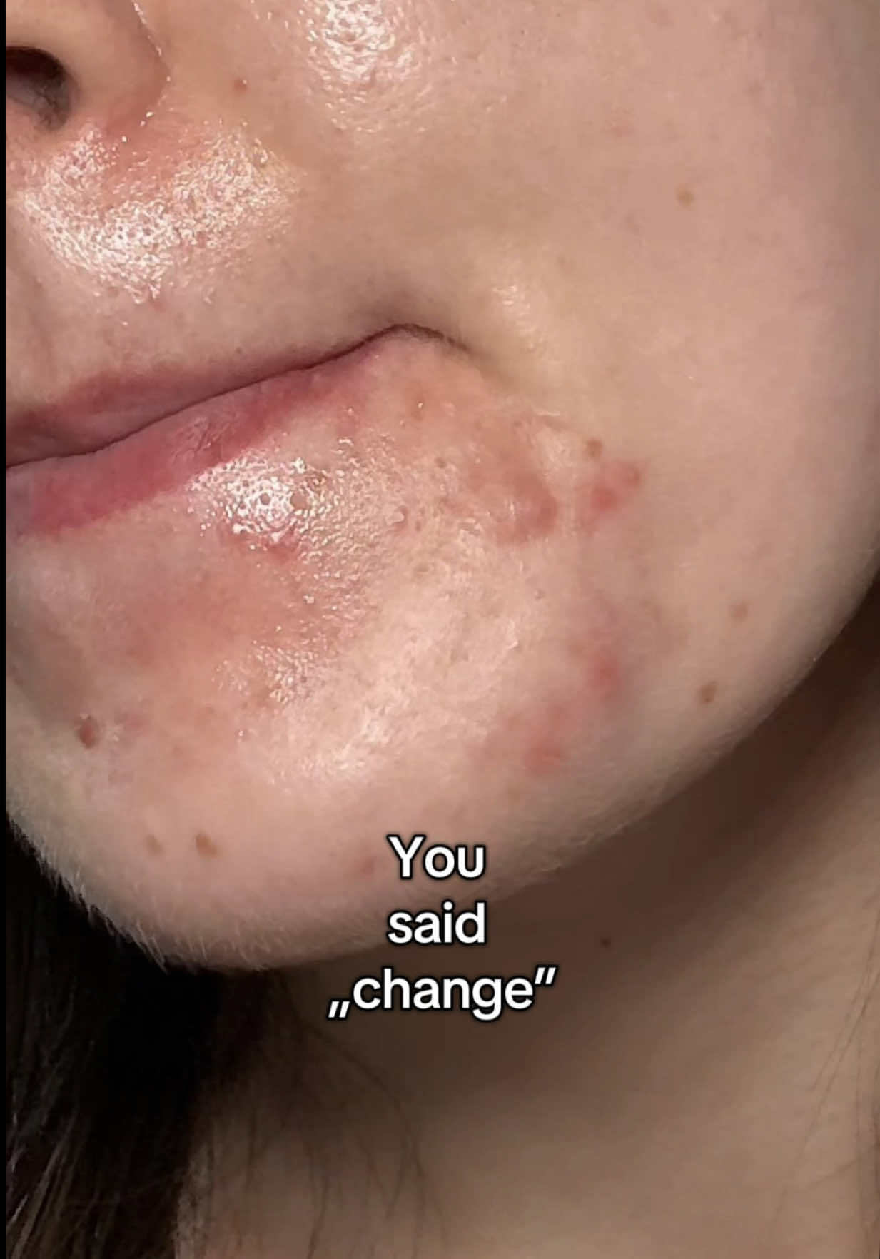 @watermelonsugarskin