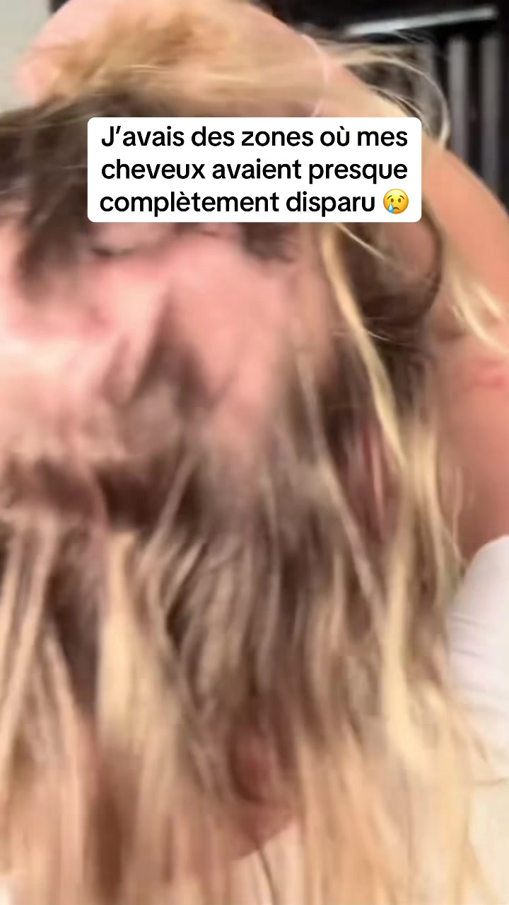 @Lux’Hair Growth