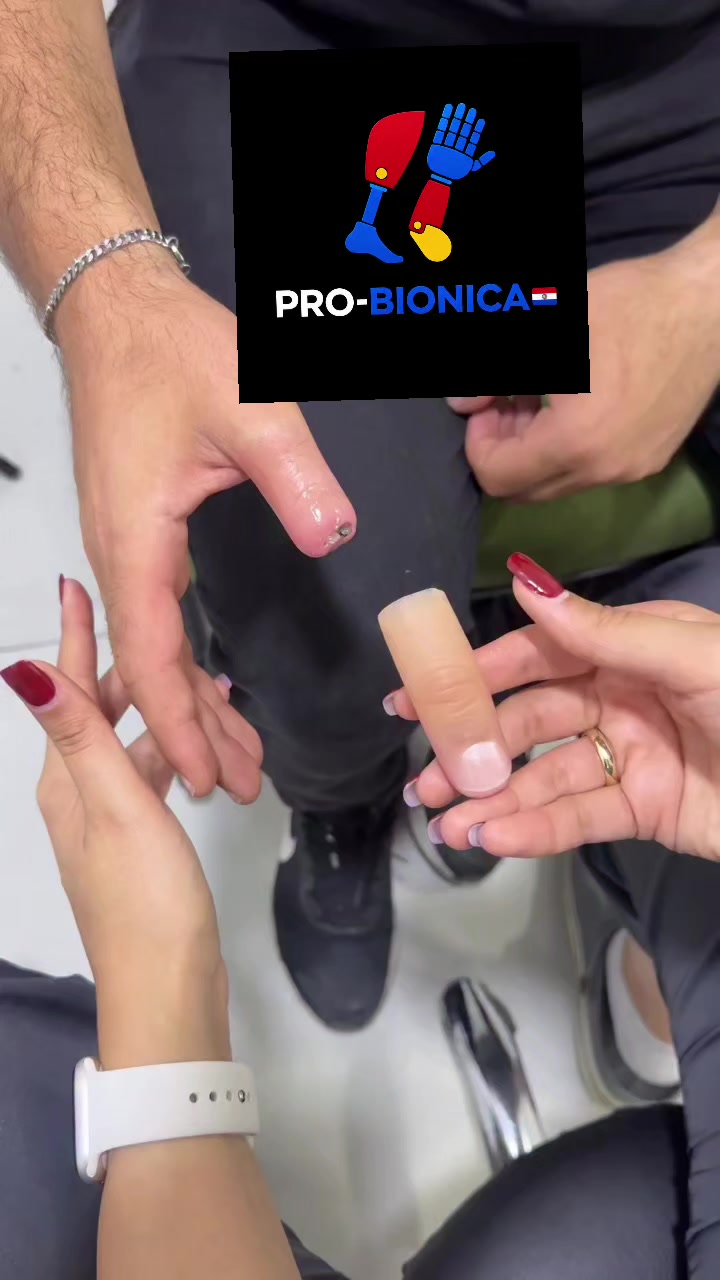 @Pro-Bionica Paraguay 🦿🦾