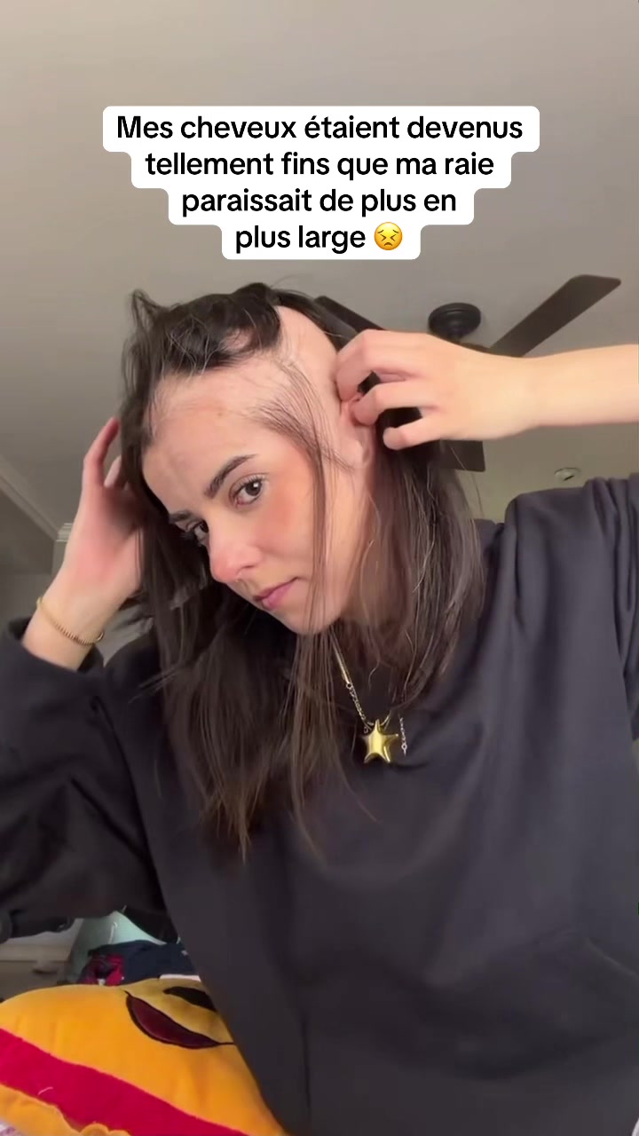 @Lux’Hair Growth