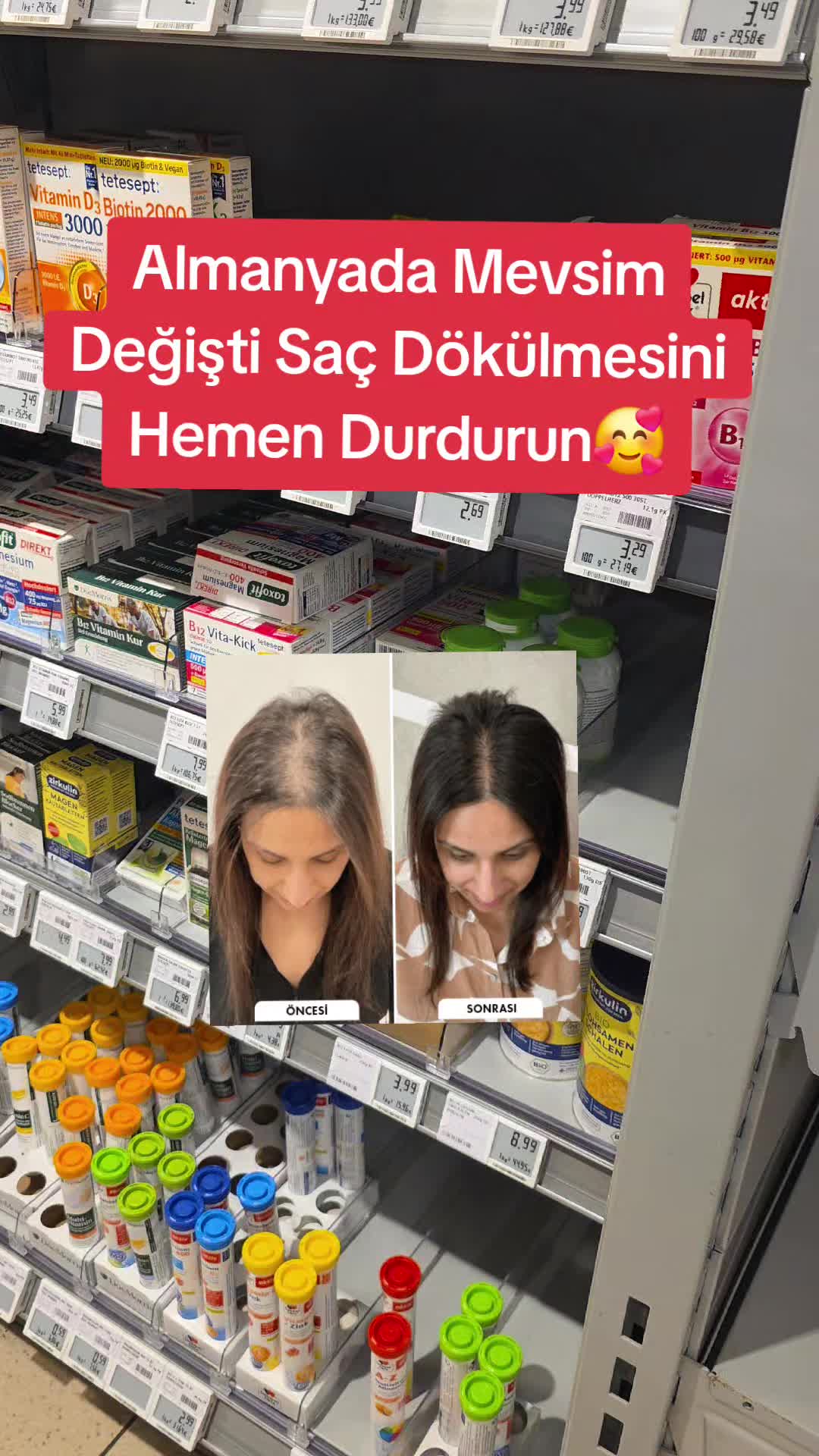 @Gurbet Ana