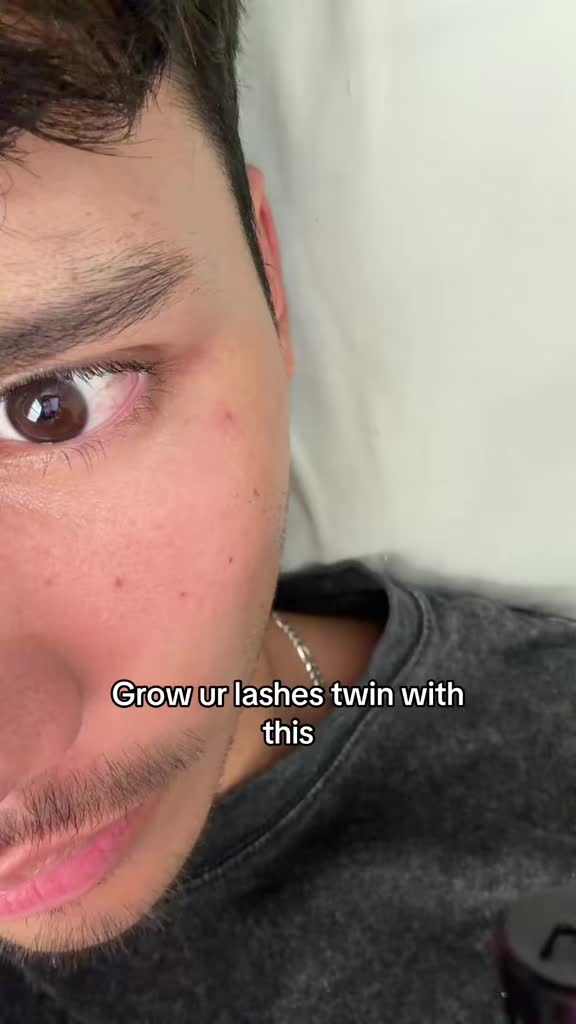 @Jacob