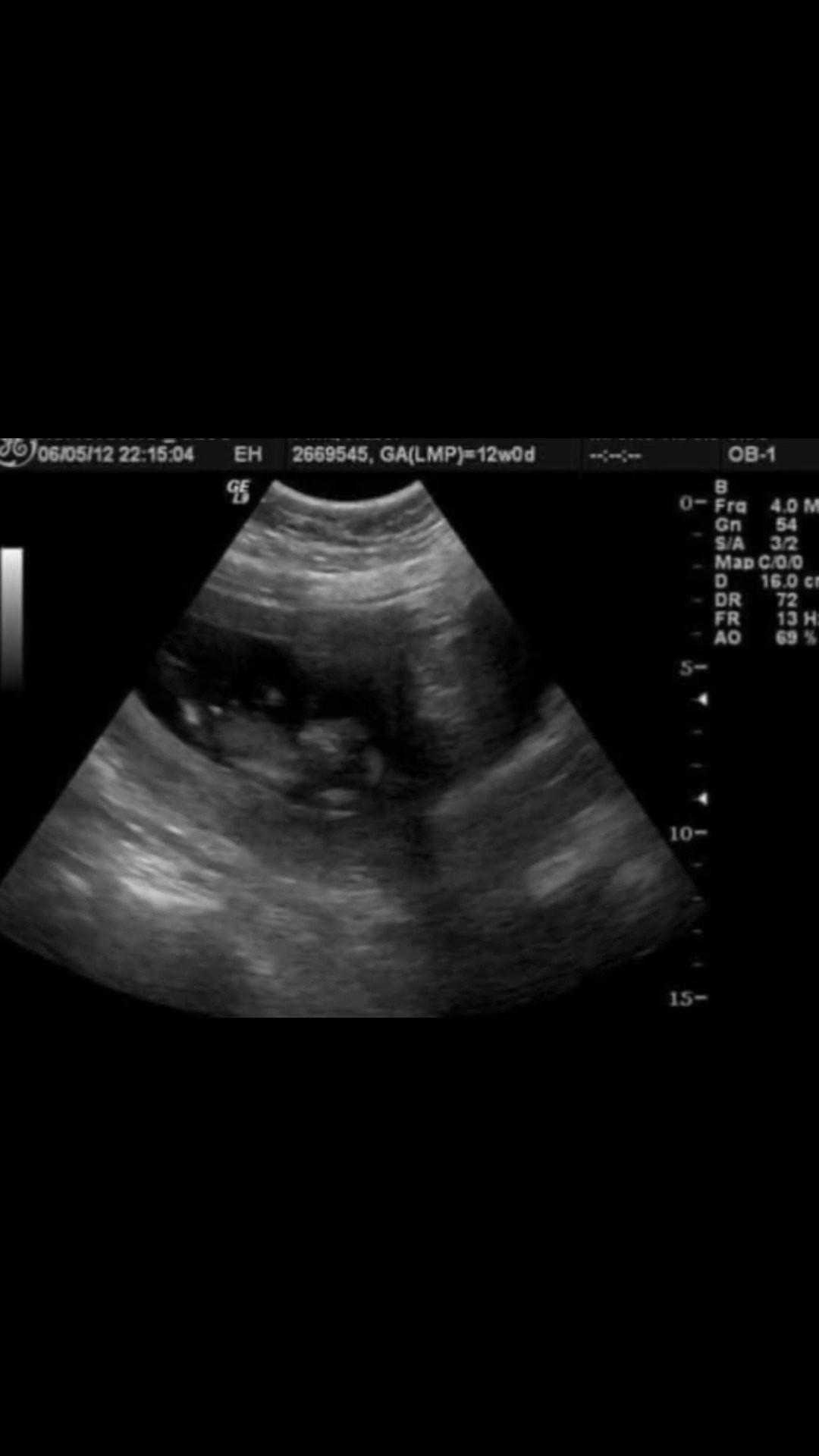 @Pregnancy Loss Network (hazel)