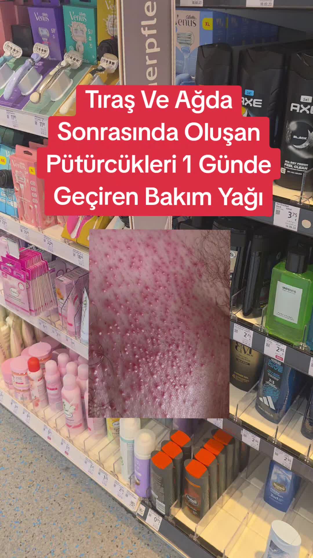 @Gurbetana27