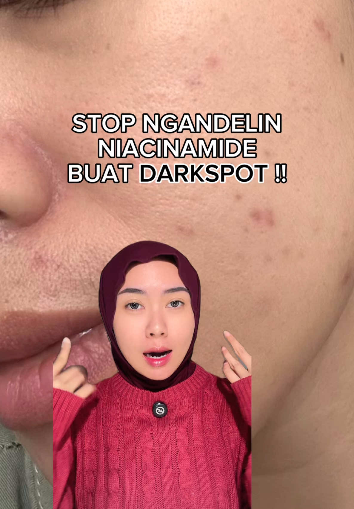 @Nonatyas