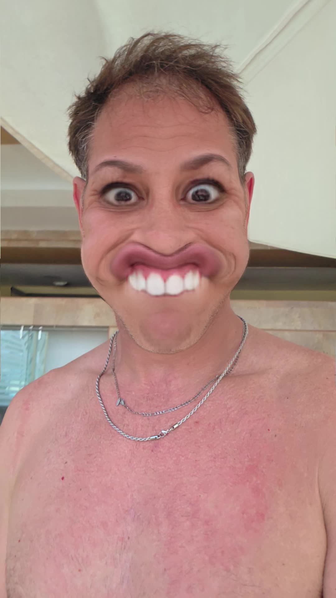@Strechedurhole