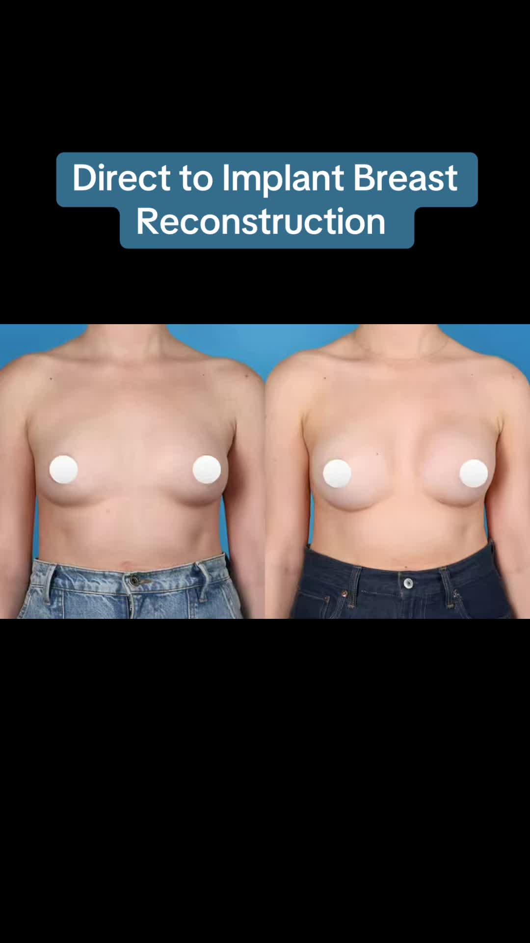 @Kelly&ensp;Killeen,&ensp;MD,&ensp;FACS