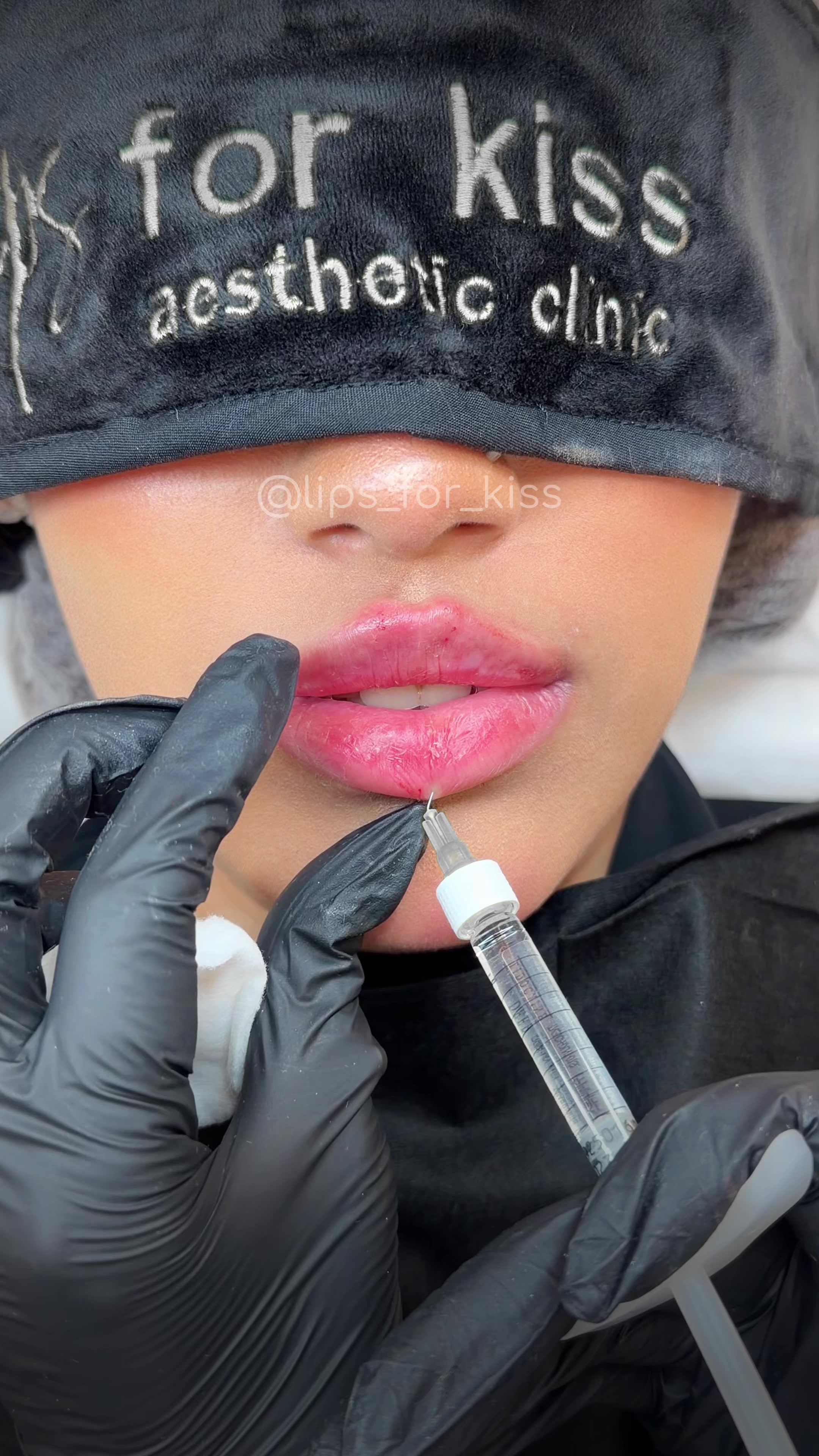 @Lips_for_kiss