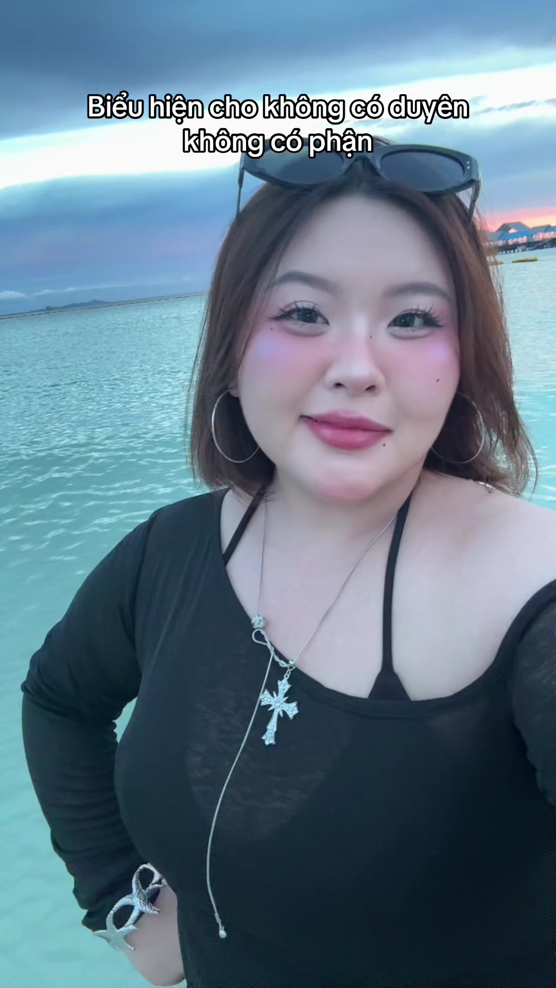 @Đu Đu sún răng