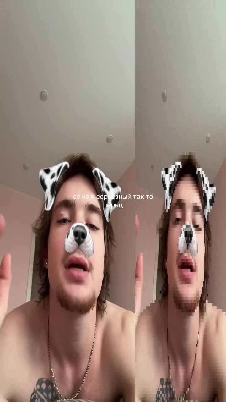@akit_300