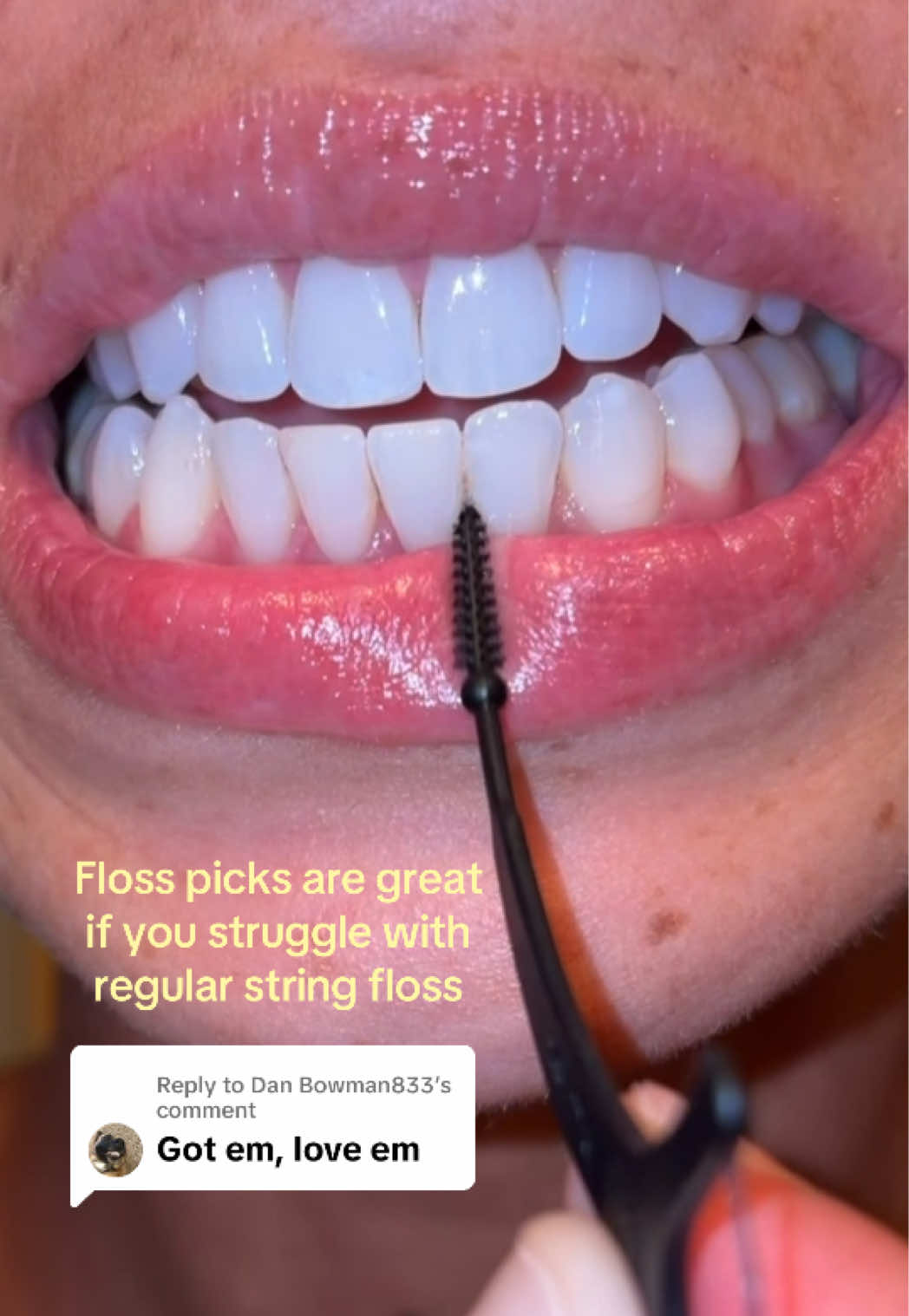 @Kellee &bull; Dental Hygienist