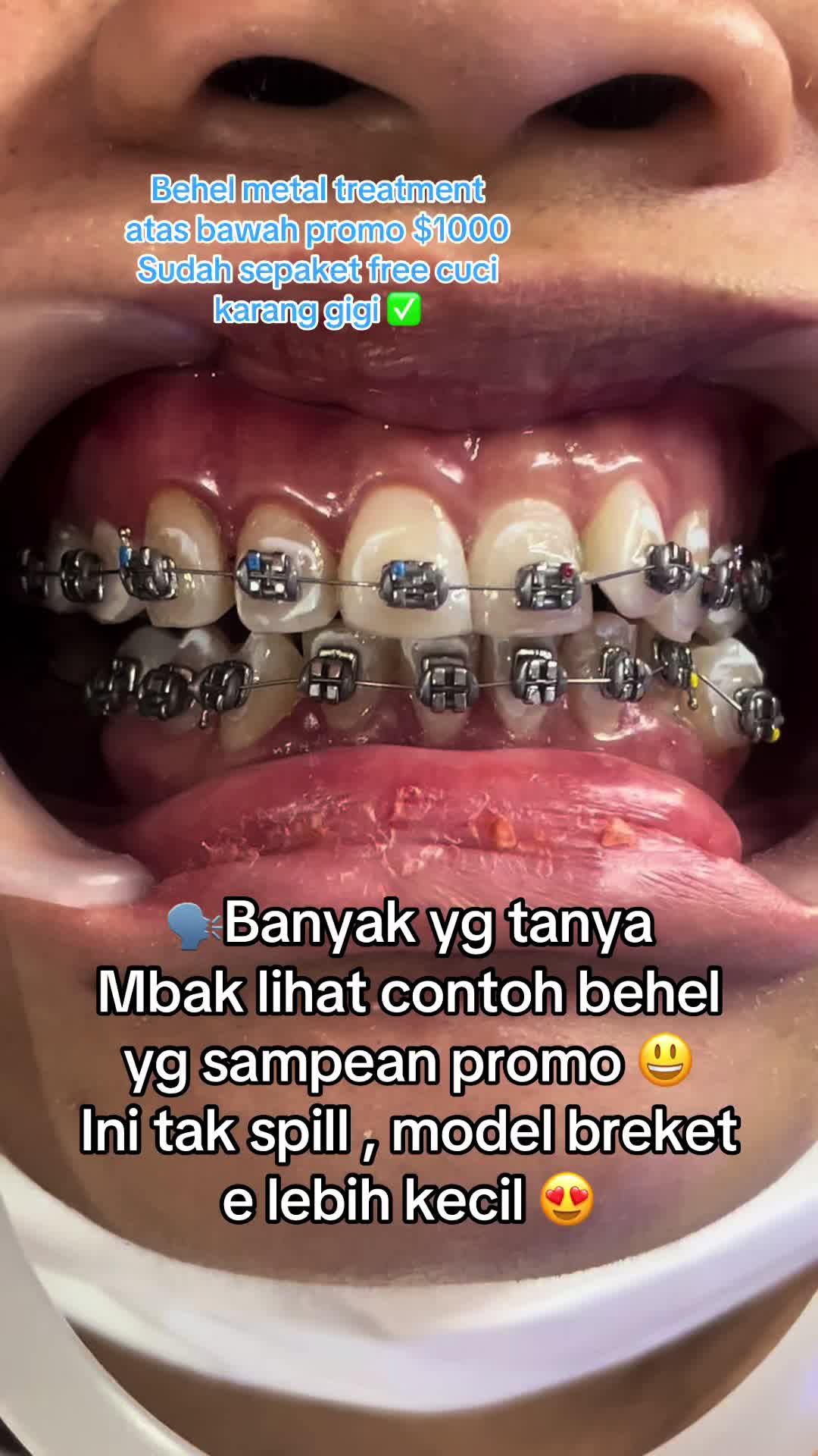 @mbak-Paijem