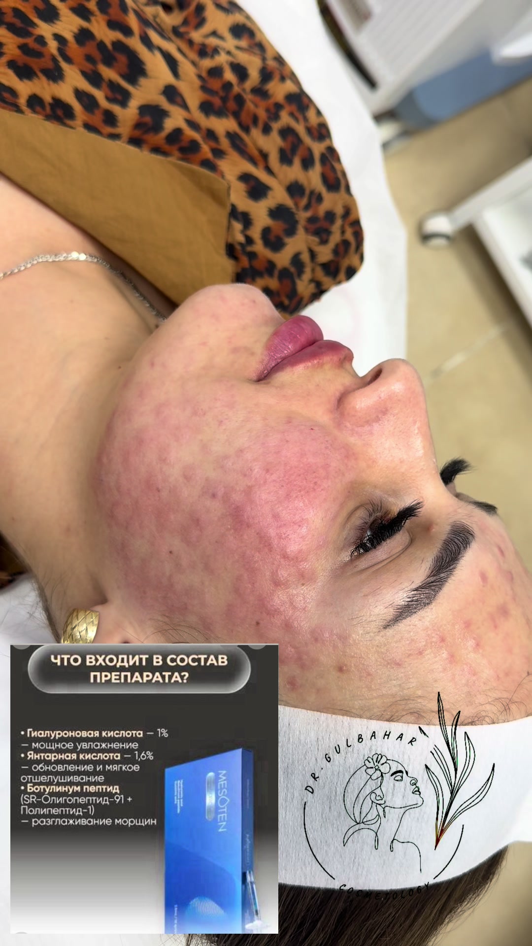@Dr_Gülbahar_Cosmetolog