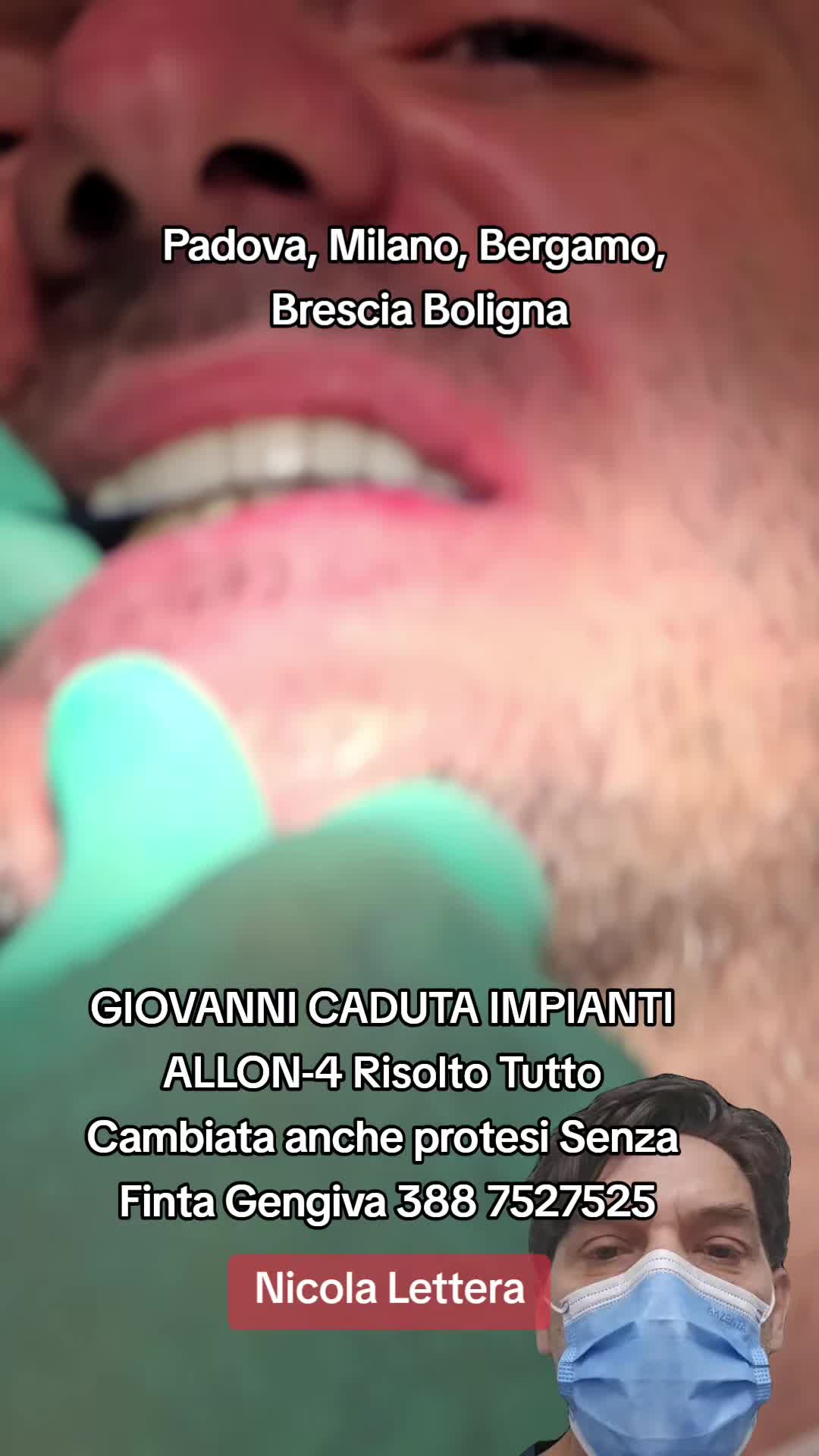 @Implantologiaprezzi