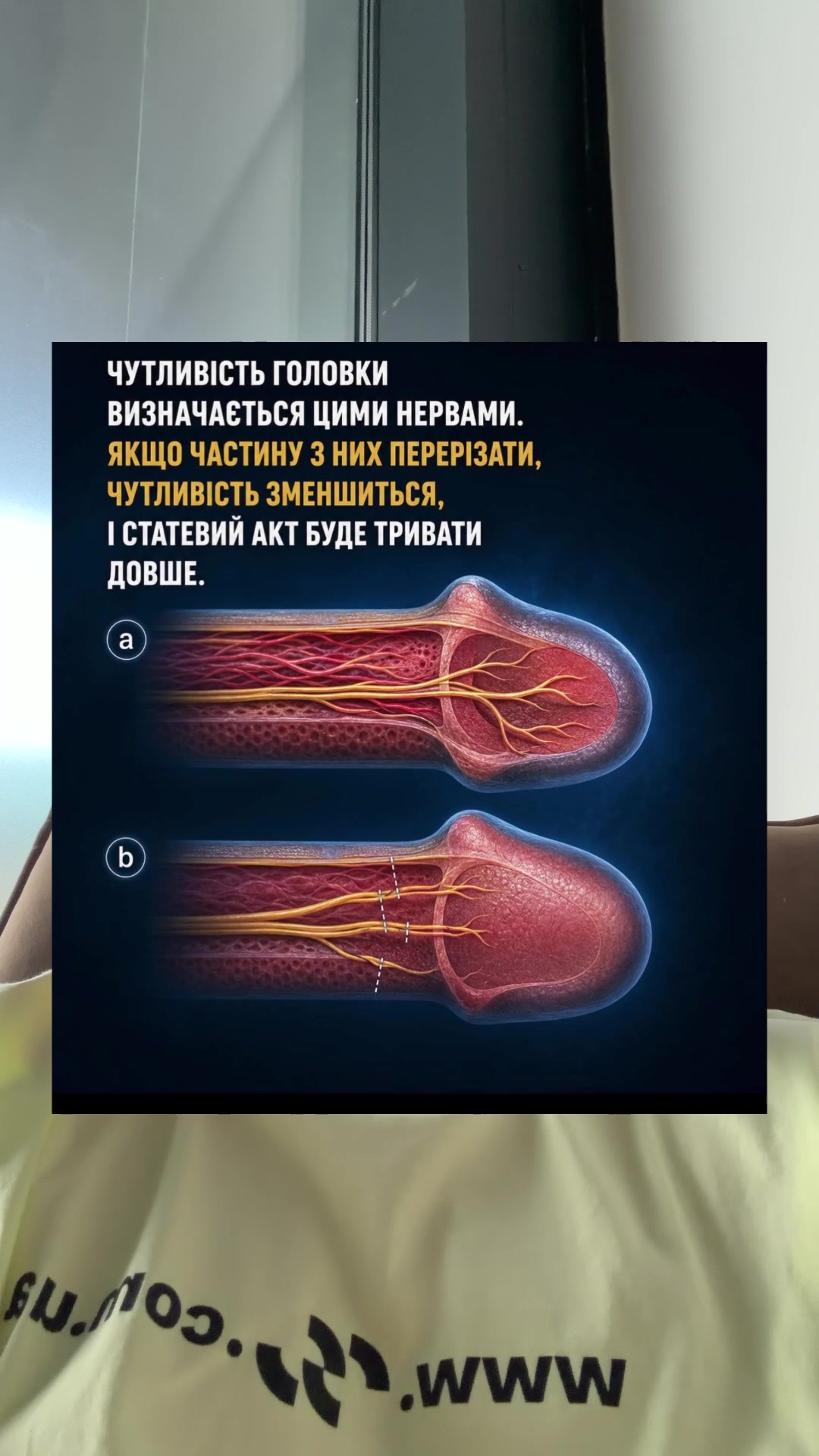 @УРОЛОГ ТІКТОКУ
