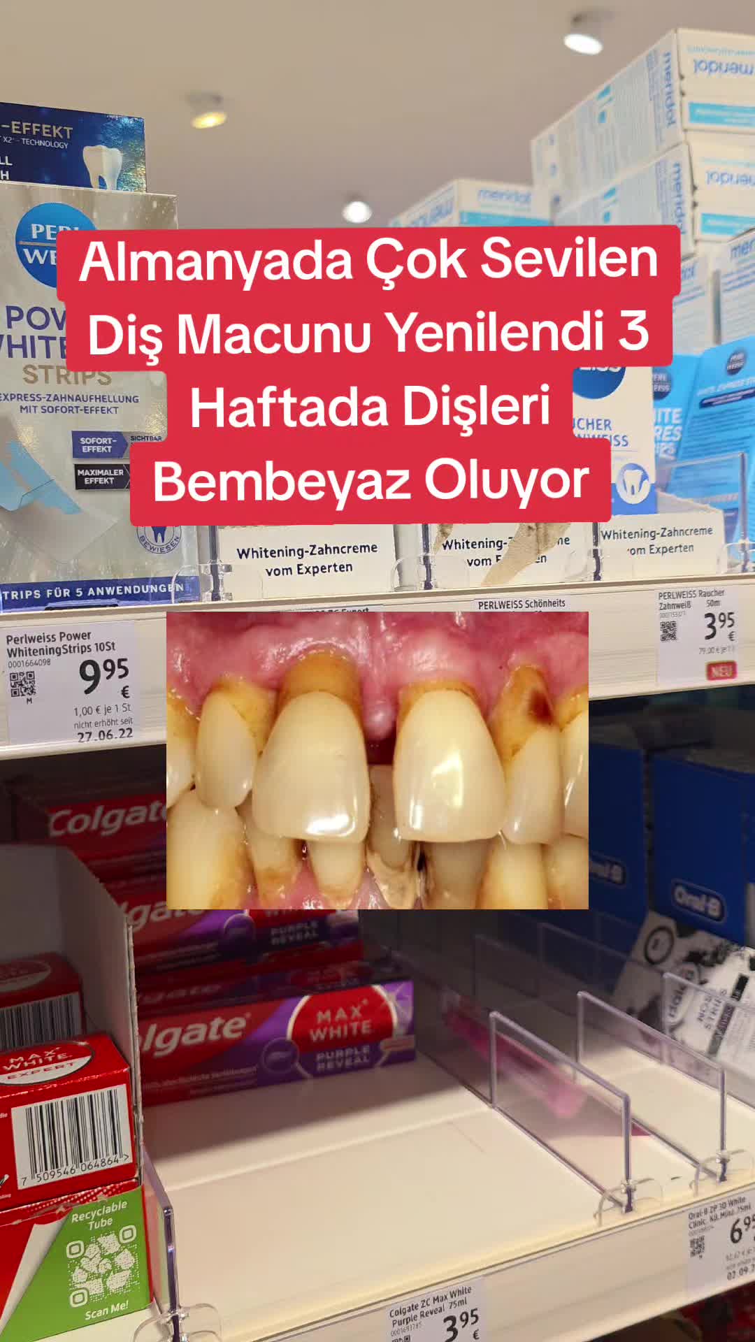 @Gurbet Ana