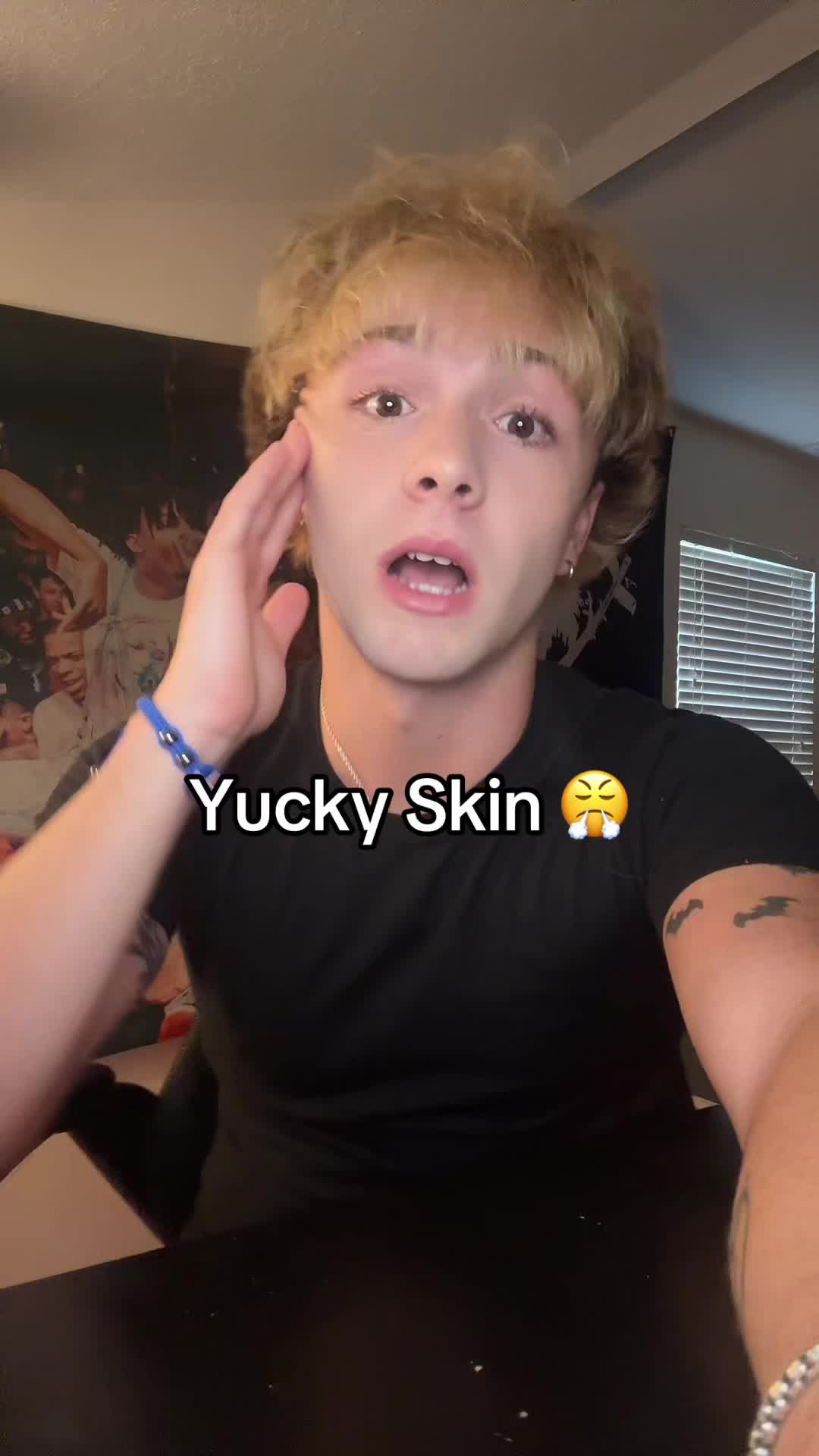 @matt burnss