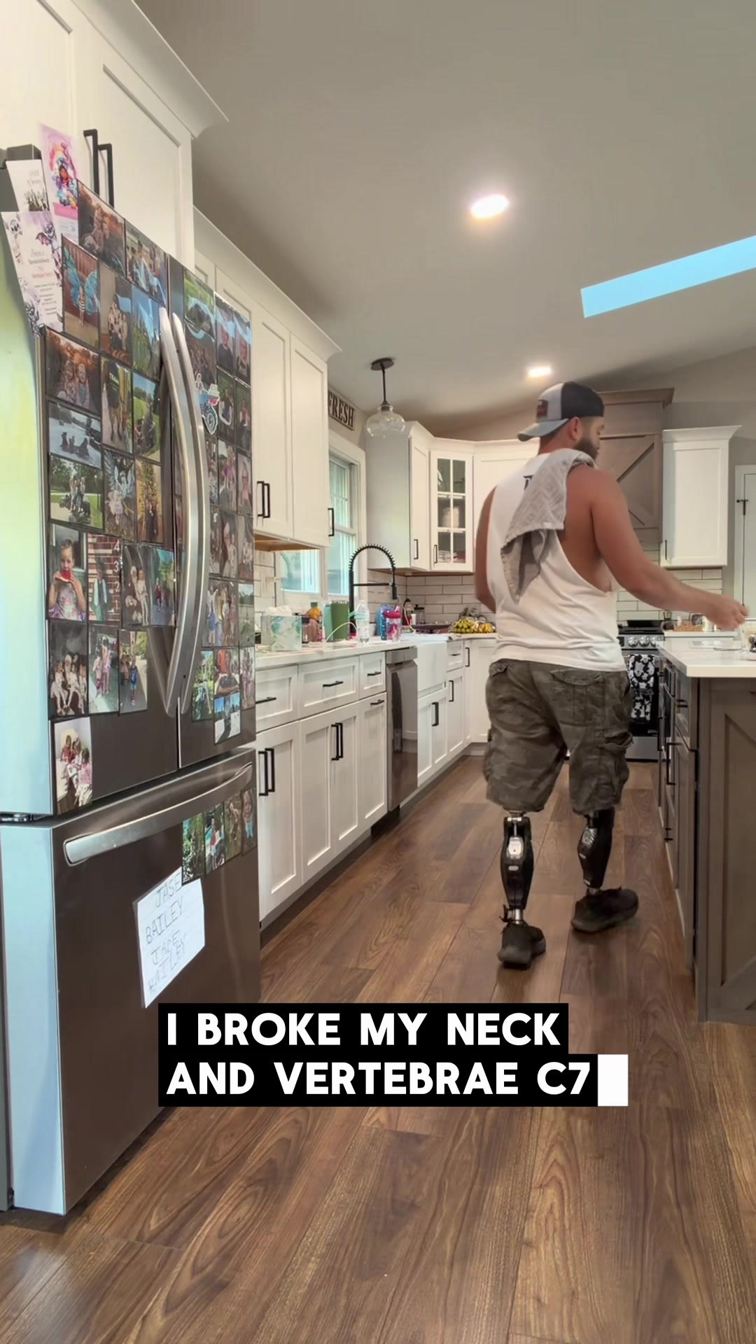 @Limb Loss Boss