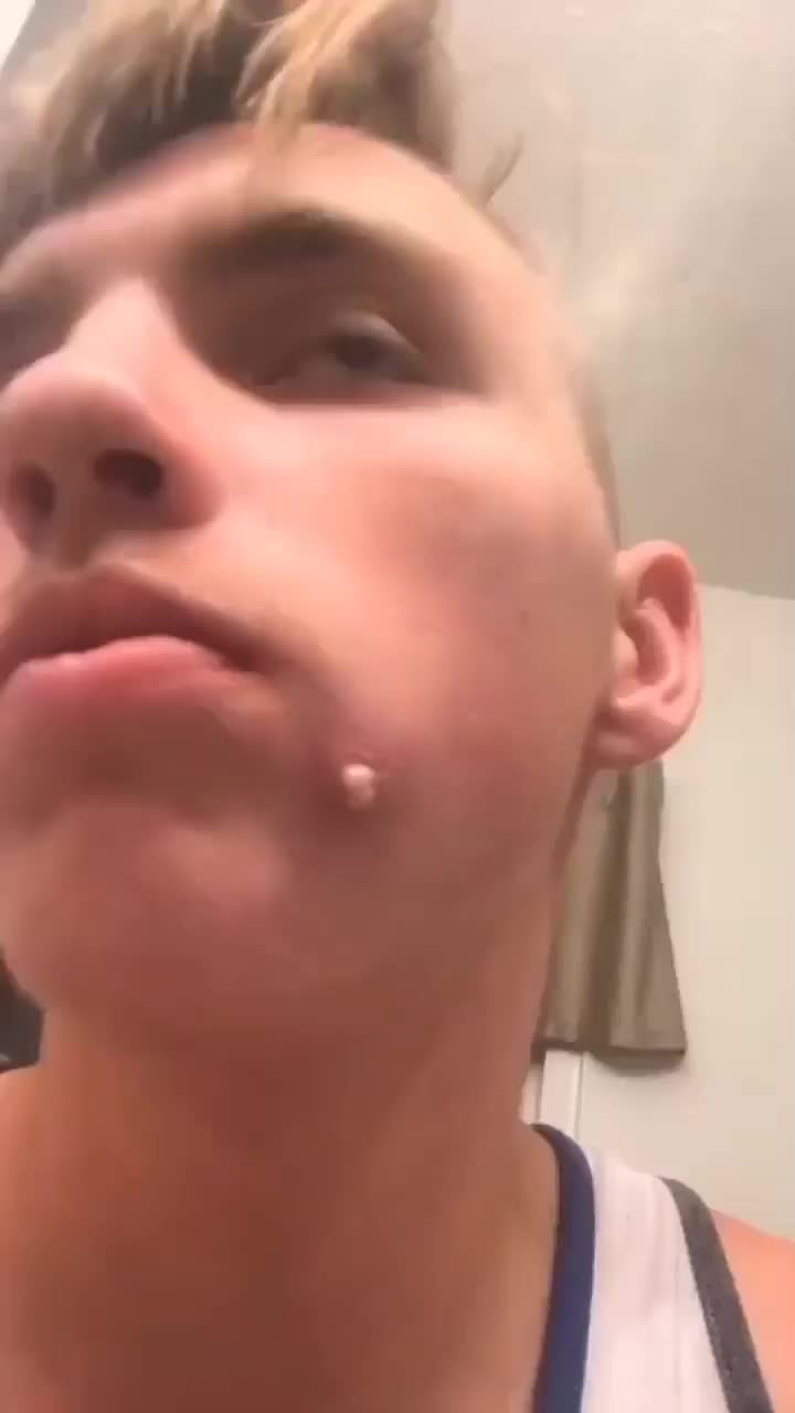 @Pimple Pooping