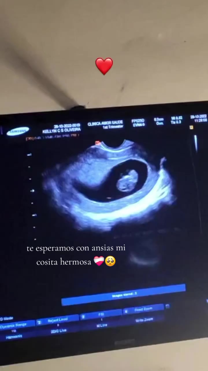 @andrea gallardo