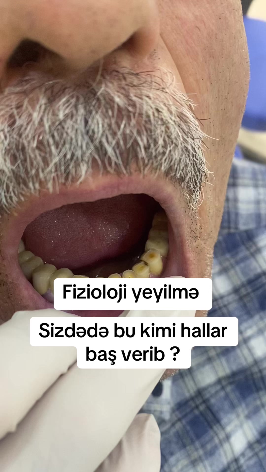 @dr_həmzət__