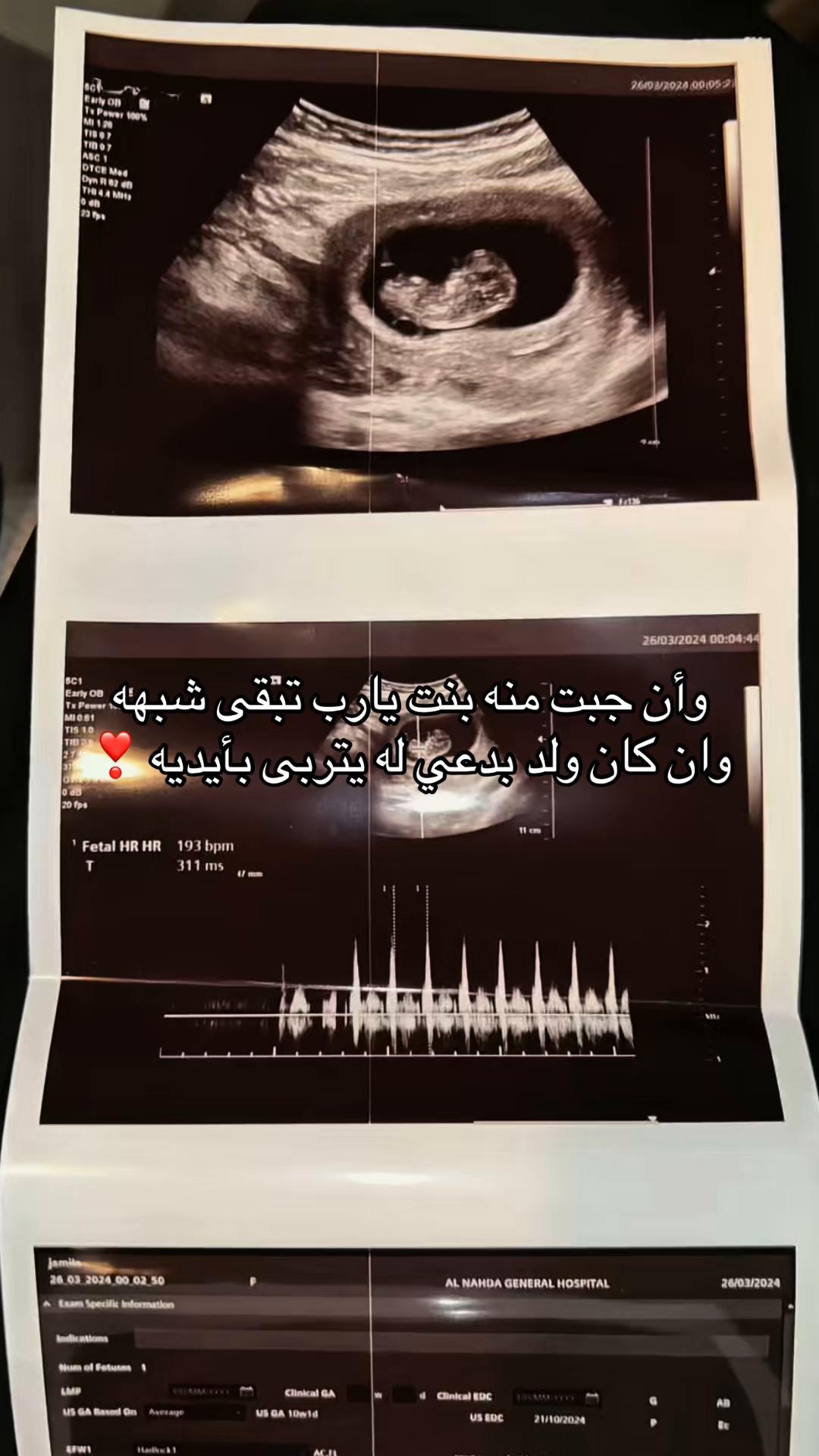 @Jameela🌷