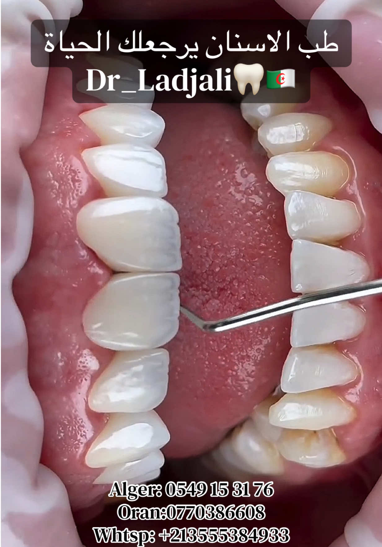 @Dr.ladjali