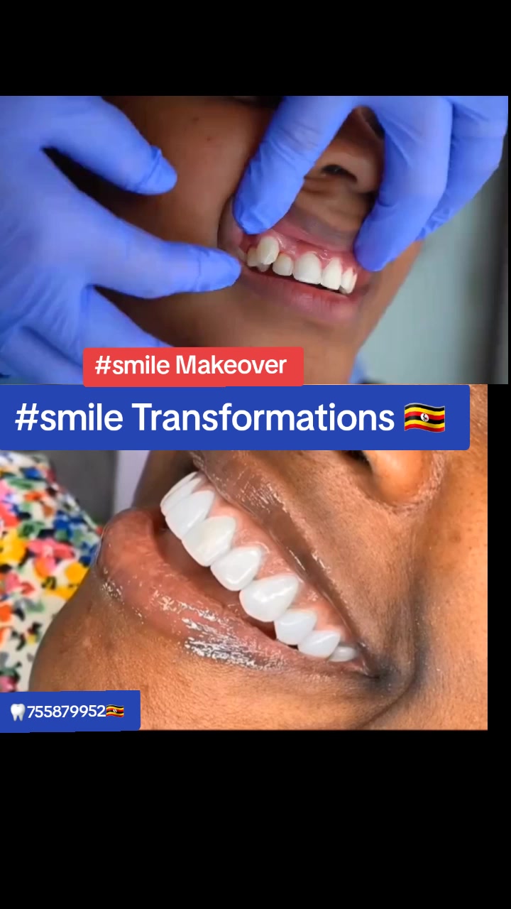 @Allianz Dental studio🦷🦷🇺🇬