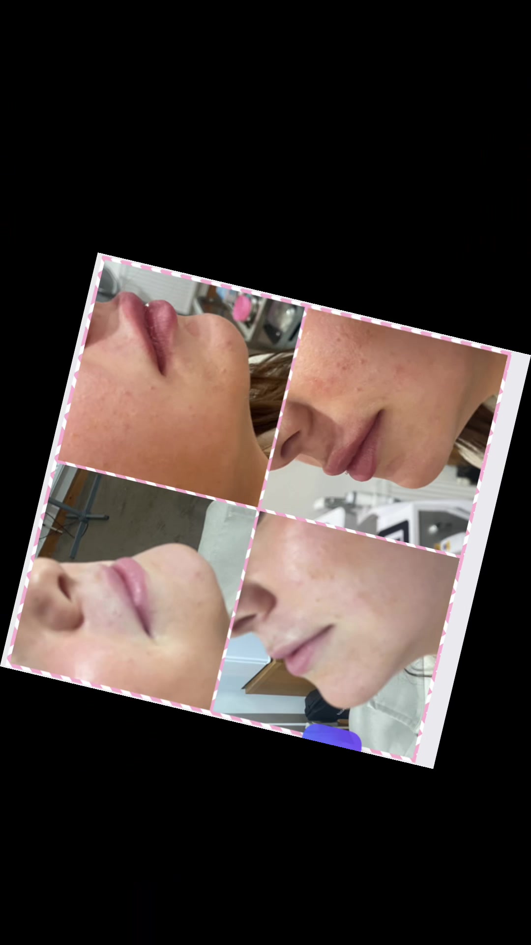 @Diamond Aesthetics Barnsley