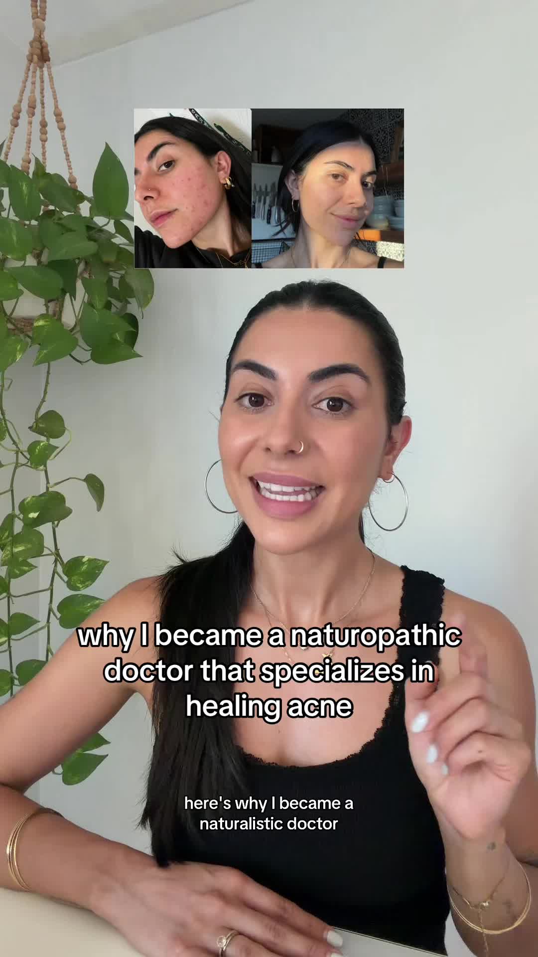@Doctor Sheyda | Acne Expert