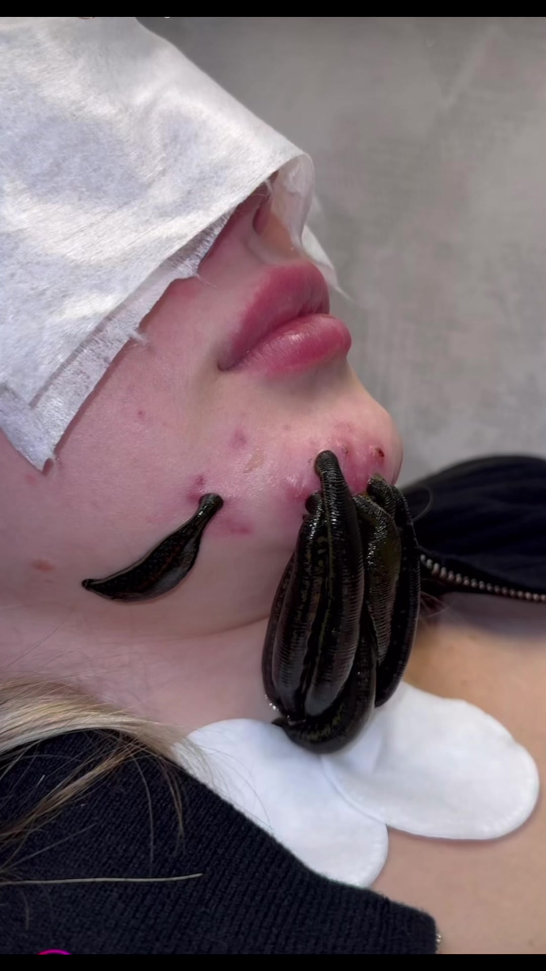 @The OC Esthetician