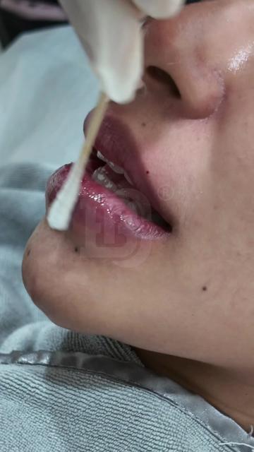 @bellaclinicmy