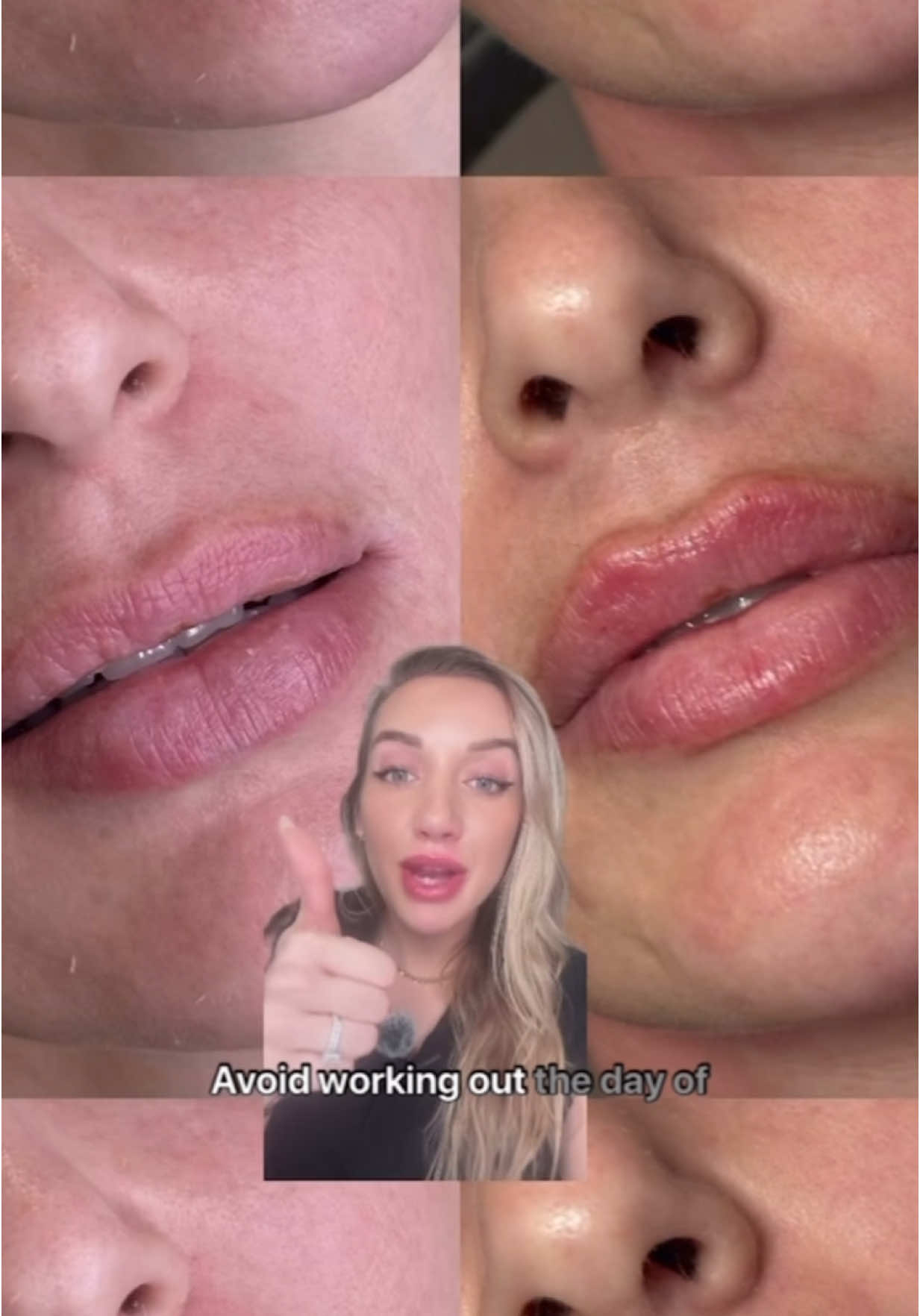@Glowtox